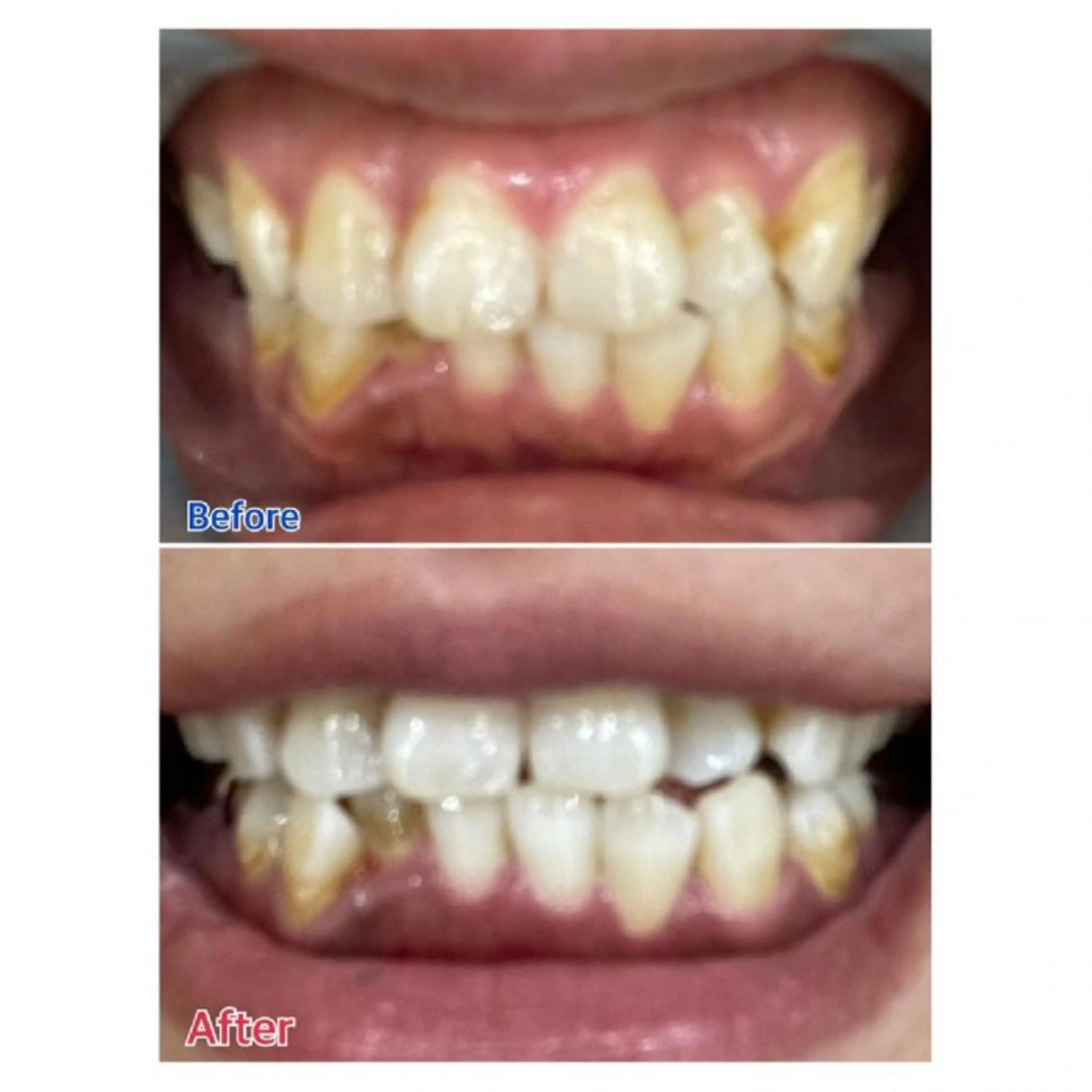 M渋谷店所属・Ｍ渋谷 ホワイトニングのその他イメージ