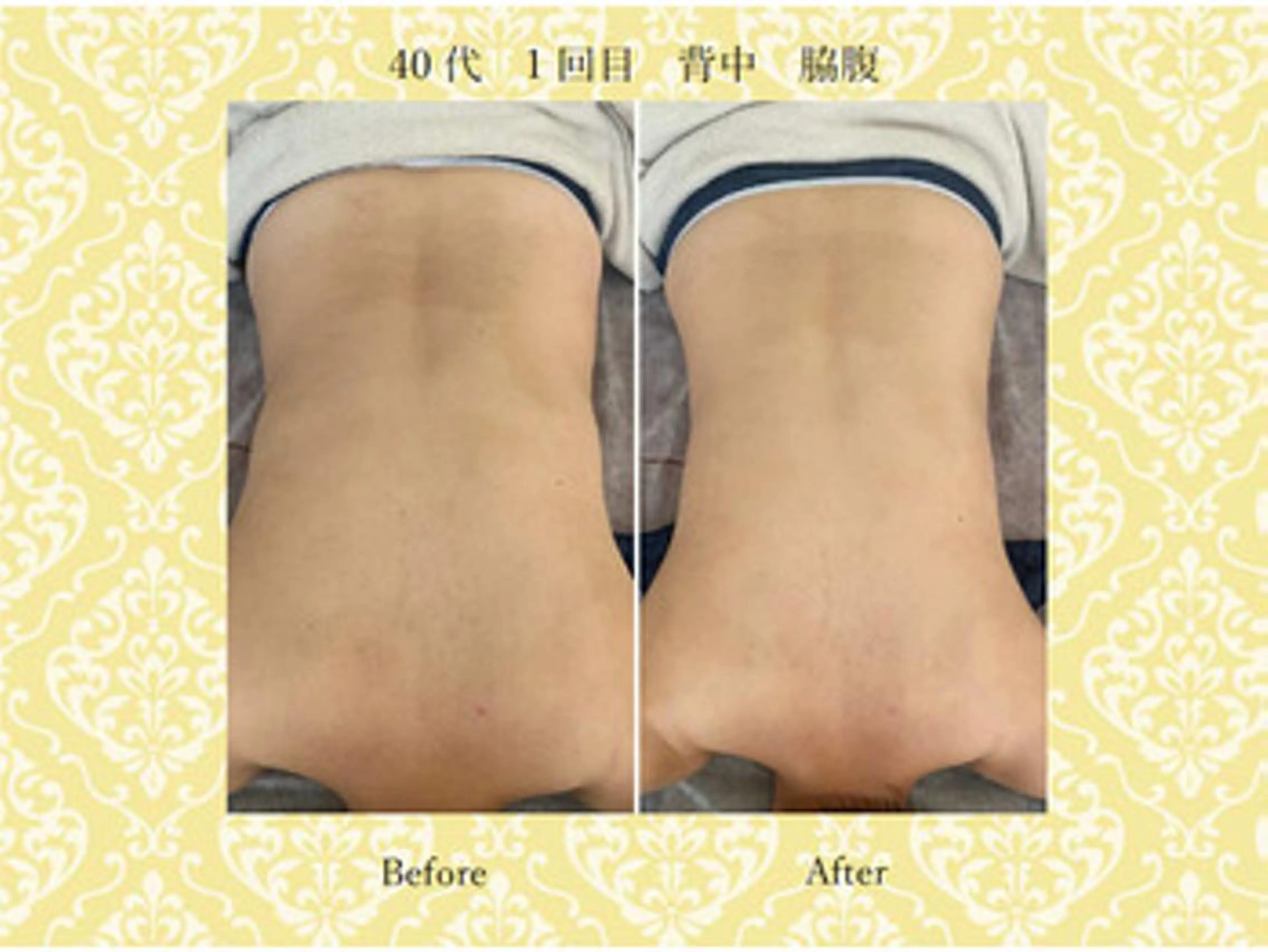 エステ 美肌専門サロン かれんのエステ・リラクイメージ