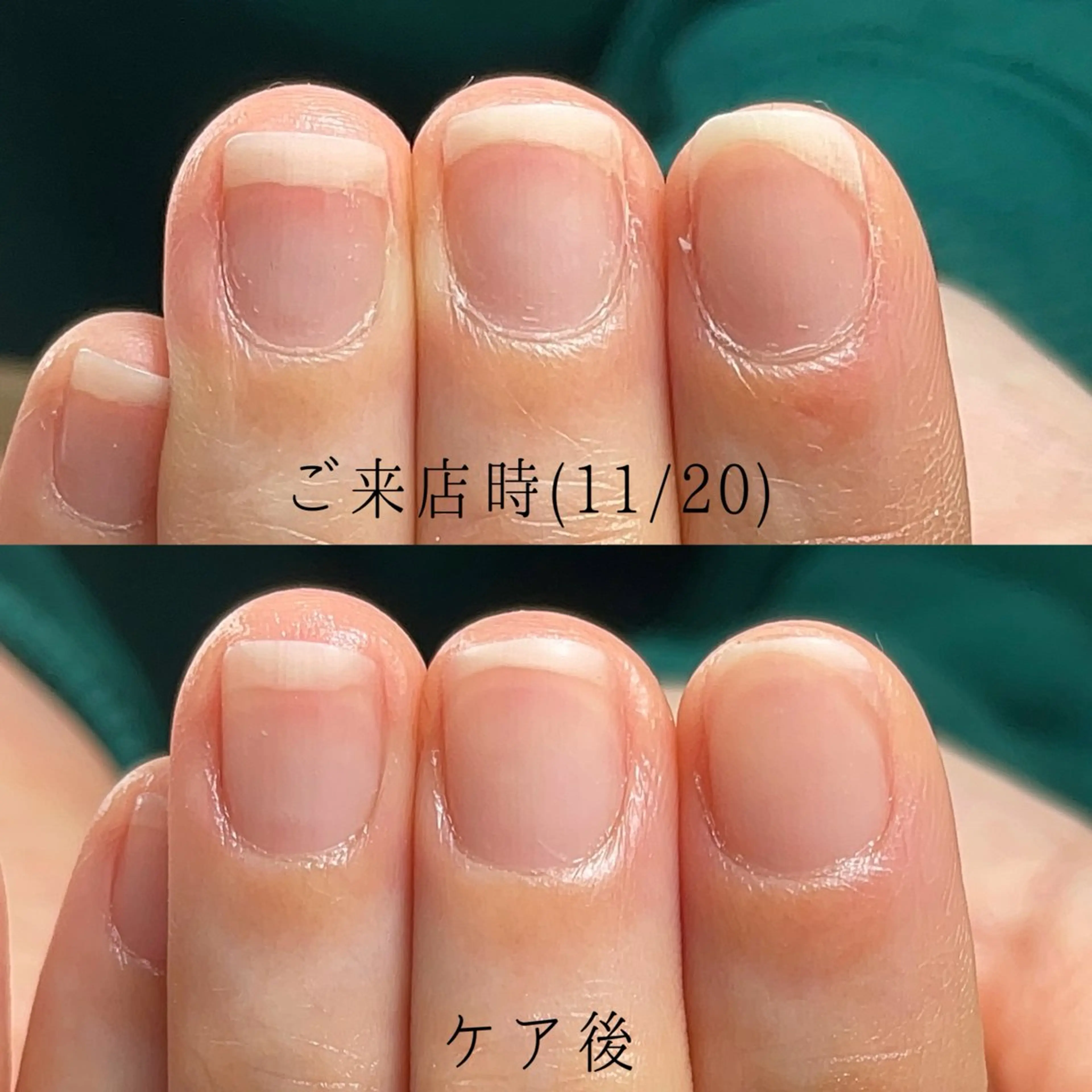 ネイル ジェルネイル Aim* 深爪・自爪育成専門店のネイルデザイン