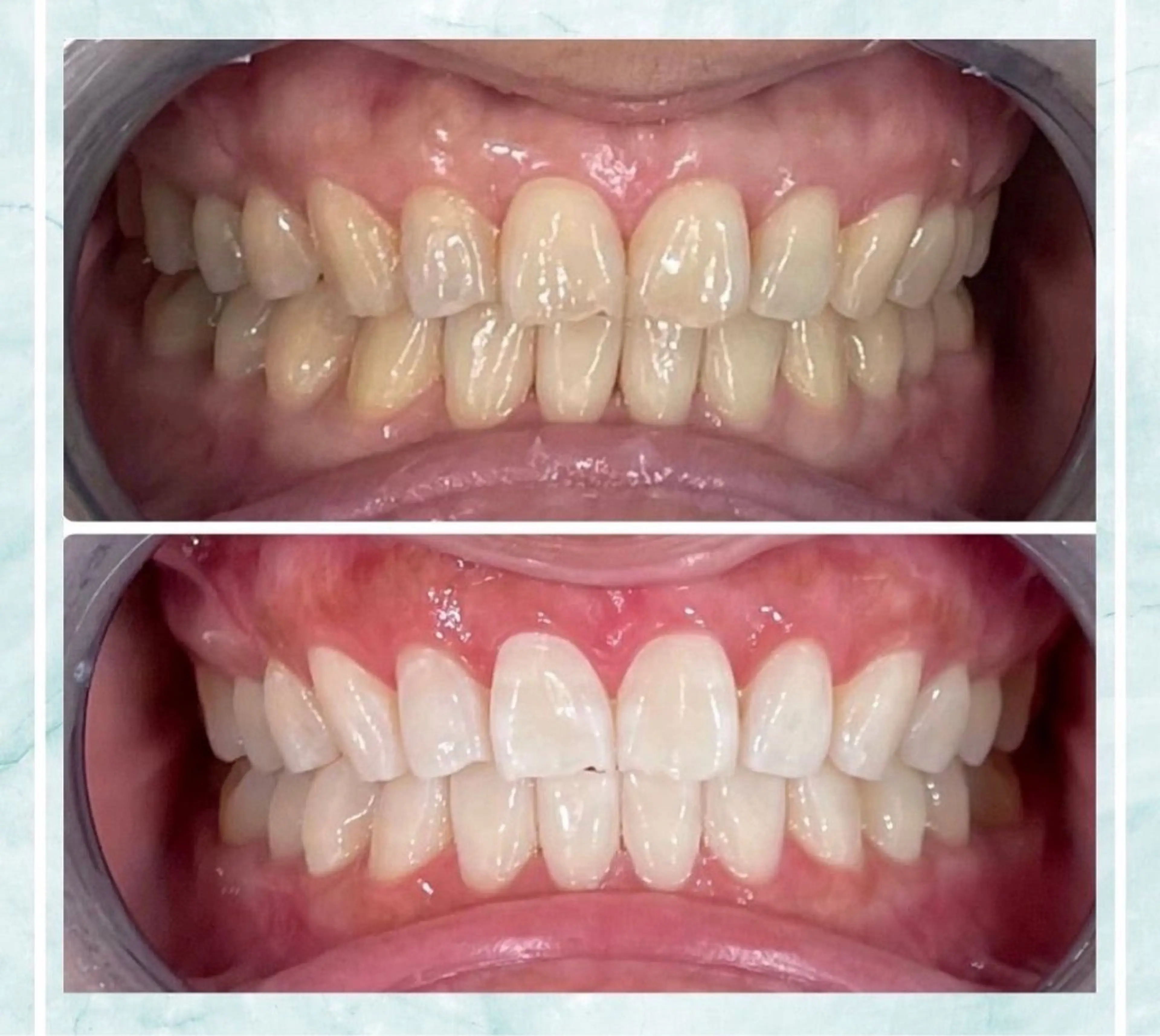 その他 ホワイトニング ビューティ名古屋栄のその他イメージ