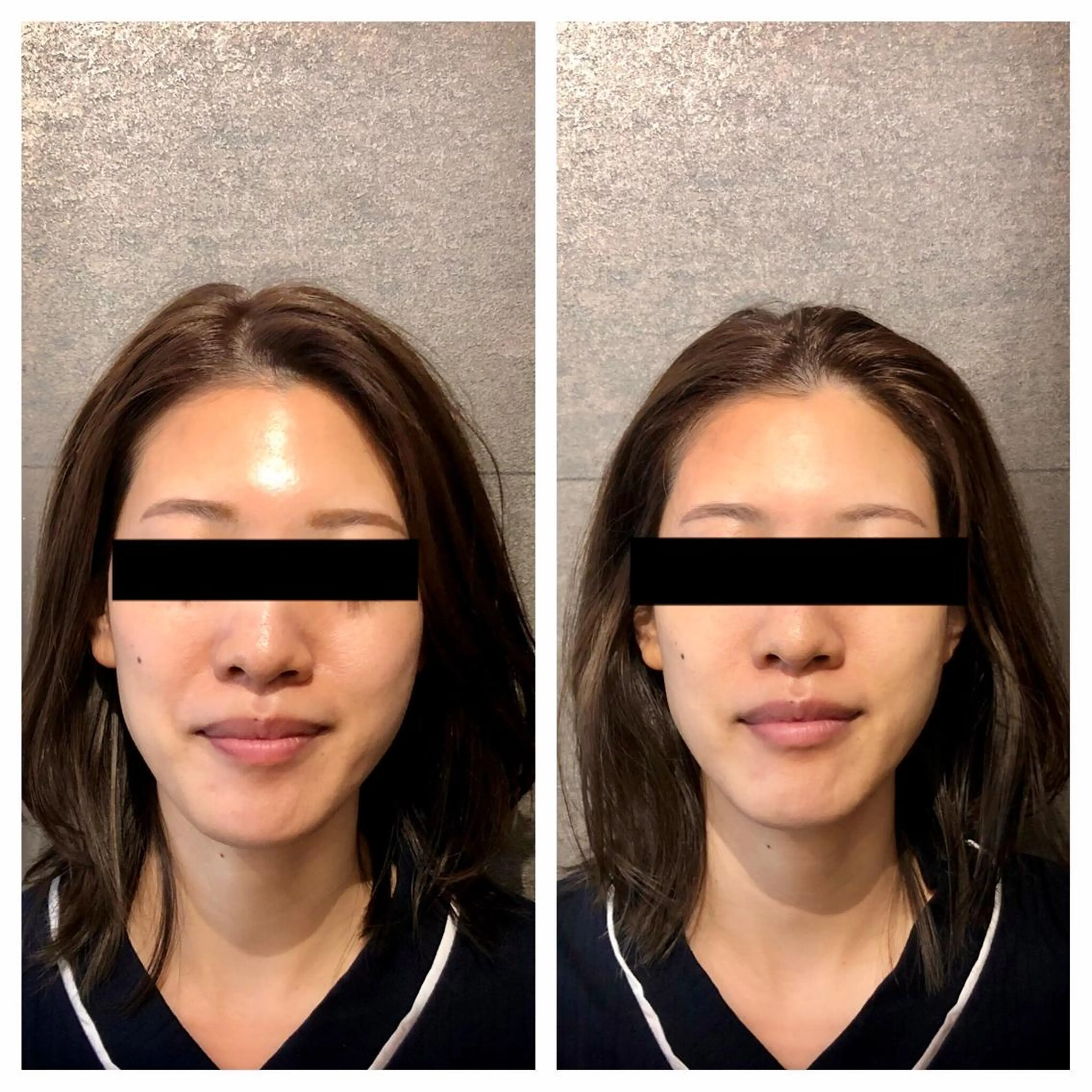 美容カイロサロンmeharu所属・目春 睦美のエステ・リラクイメージ