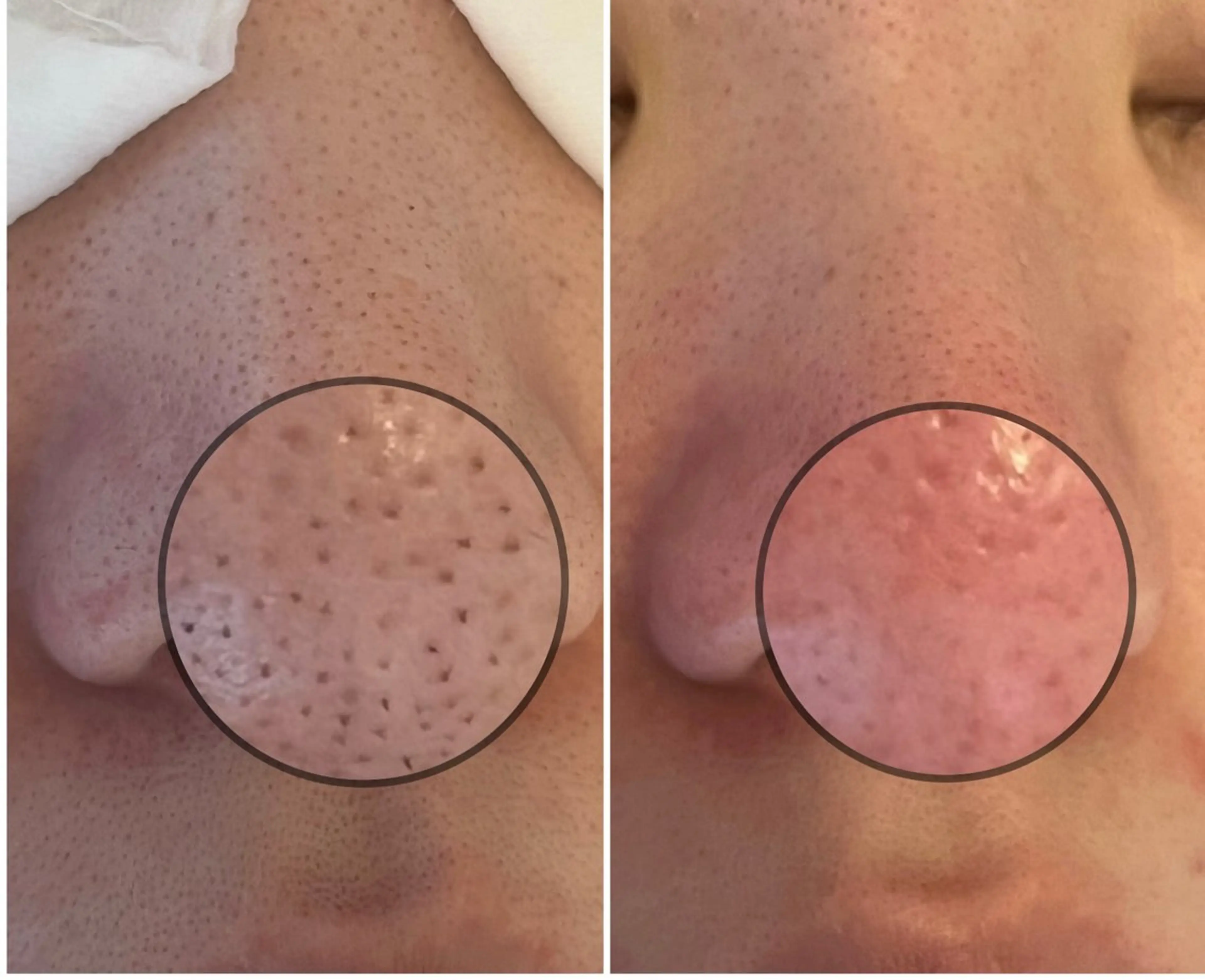 ulu 眉毛ハーブ毛穴肌改善の眉毛・アイブロウイメージ