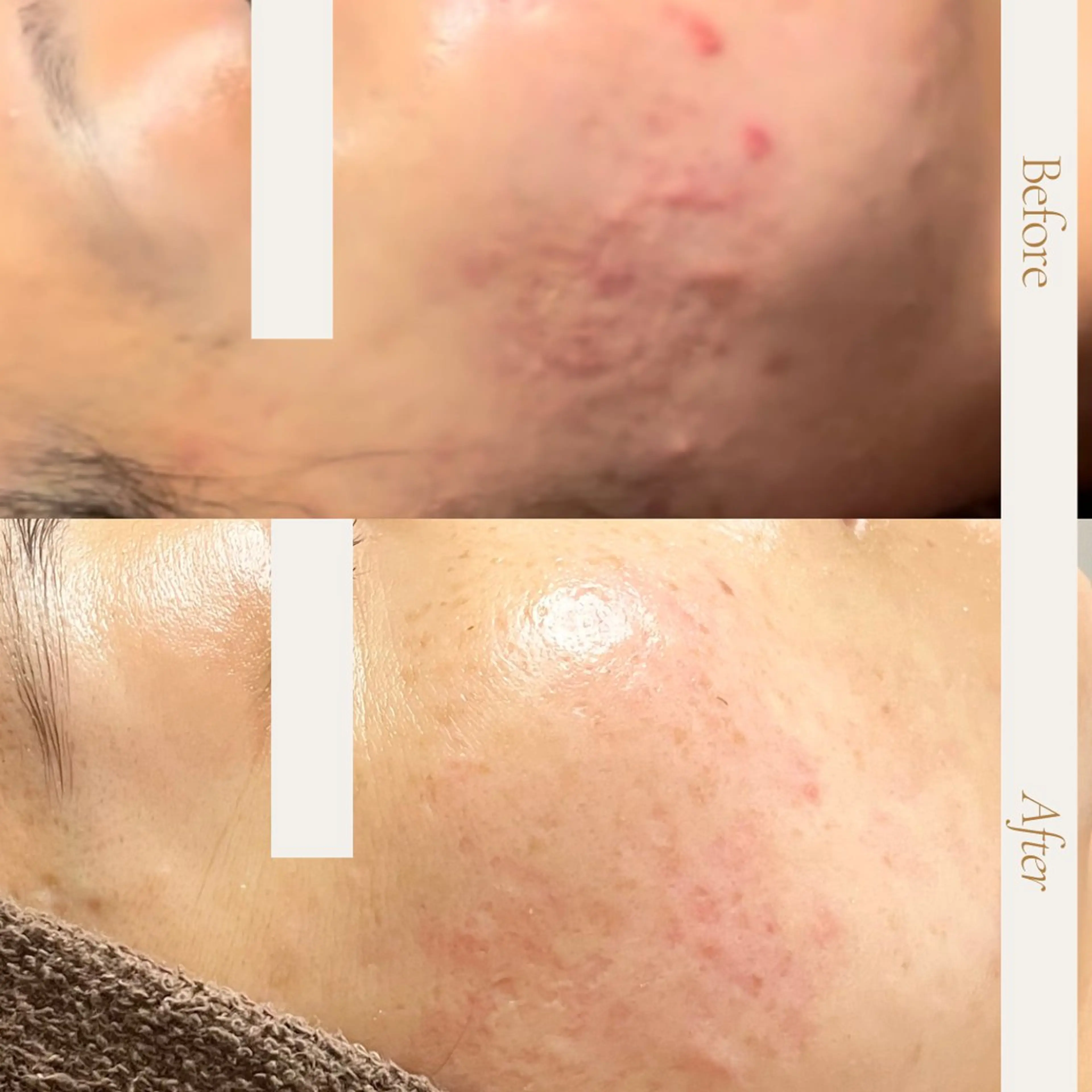 エステ 【フェムケア専門店】 PEQLIAヒロミのエステ・リラクイメージ