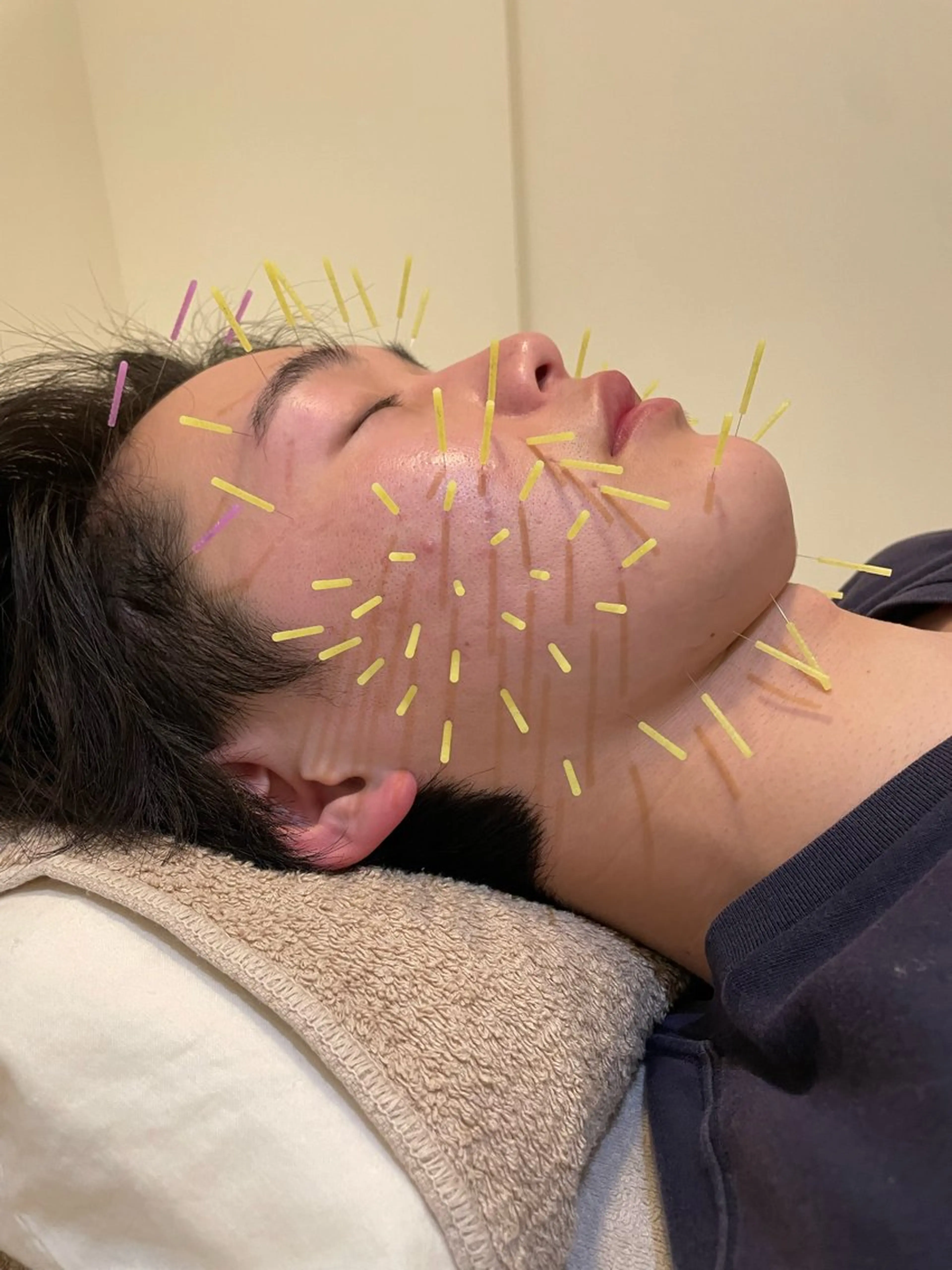 中村 峻也(鍼灸師)のエステ・リラクイメージ