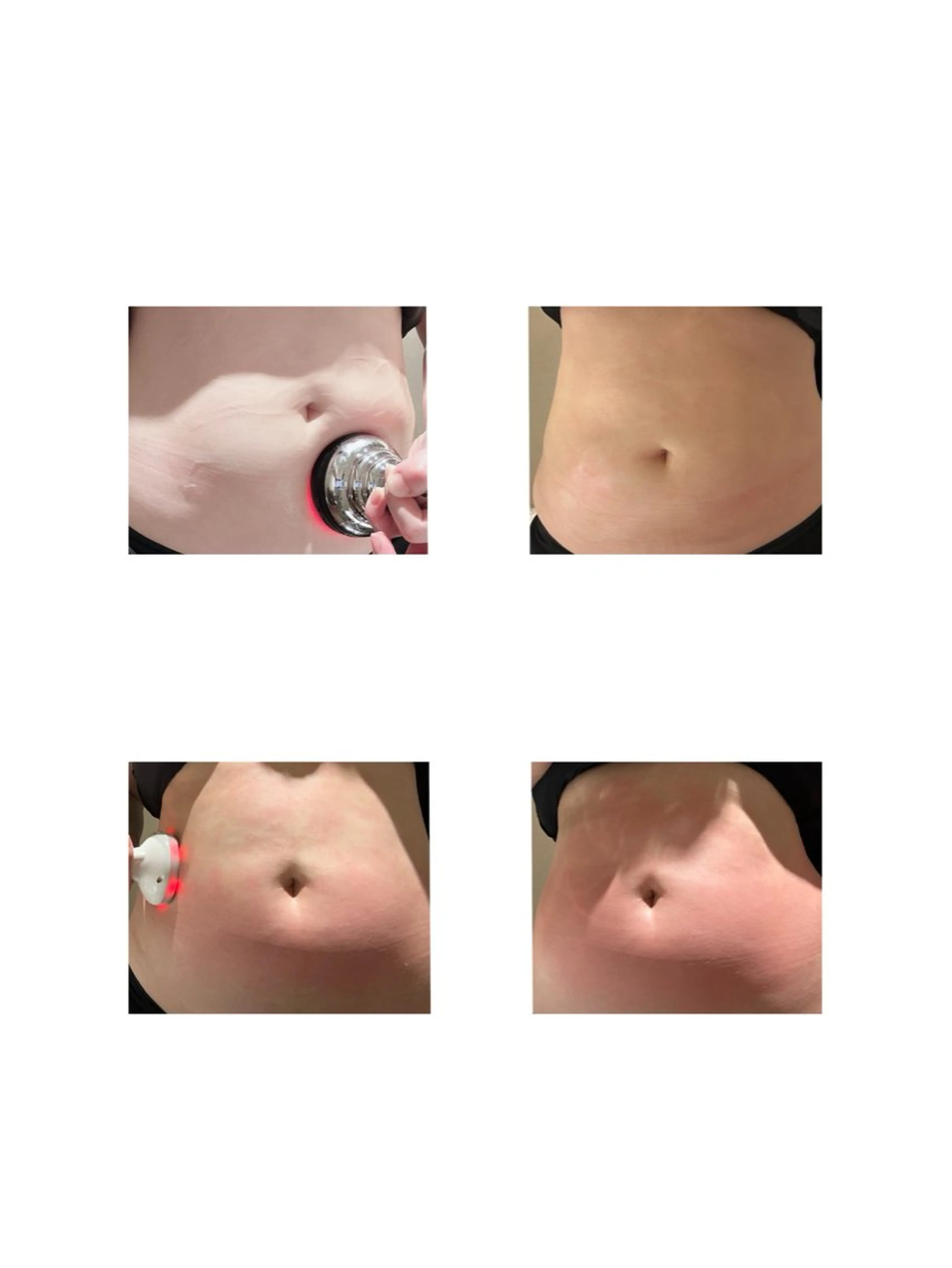 GRANLUXE所属・.*痩身.脱毛 リラク前田*･のエステ・リラクイメージ