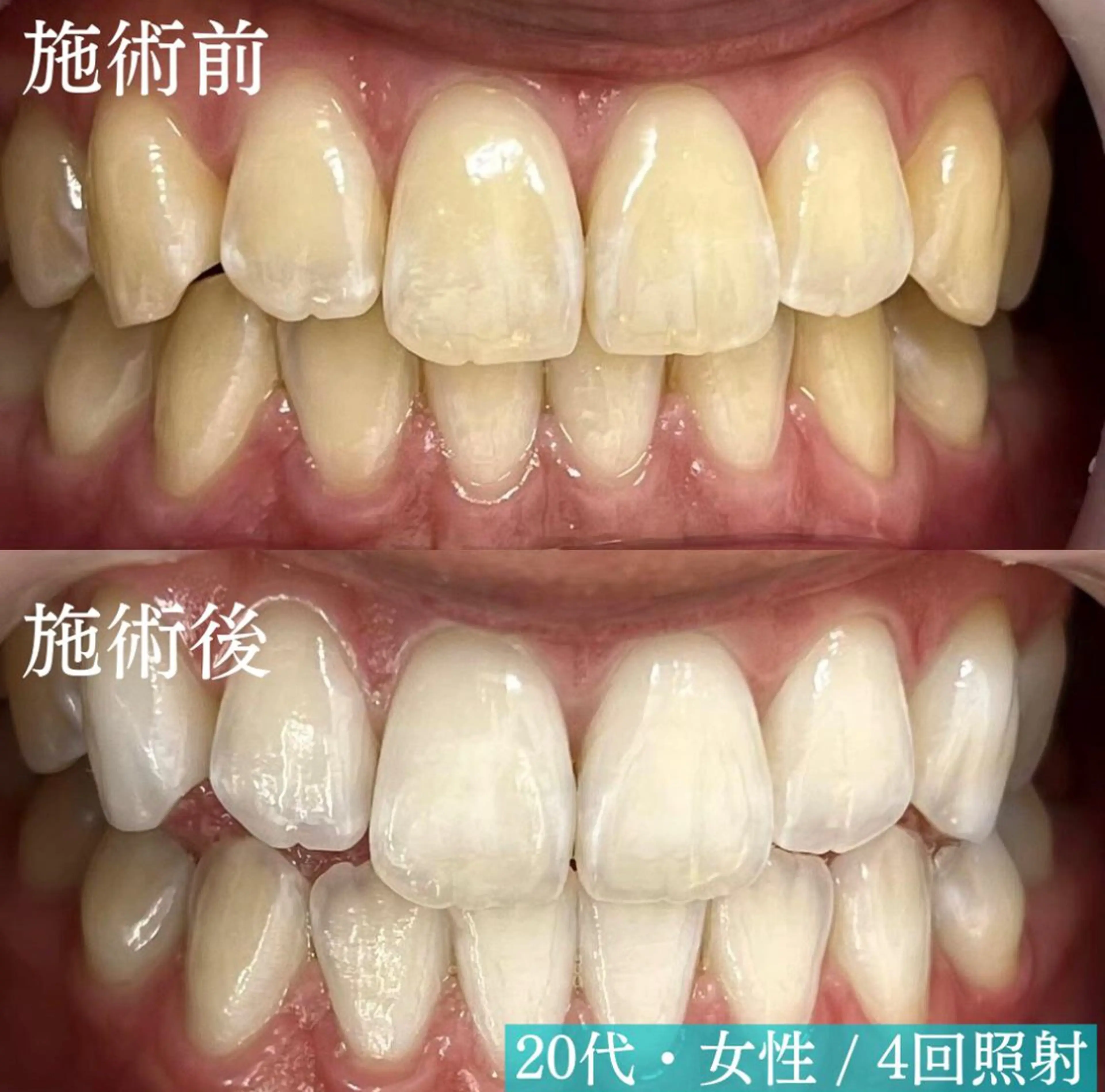 エステ リラク LBSホワイトニング上野店所属・LBSホワイトニング 🌐 上野店公式のエステ・リラクイメージ