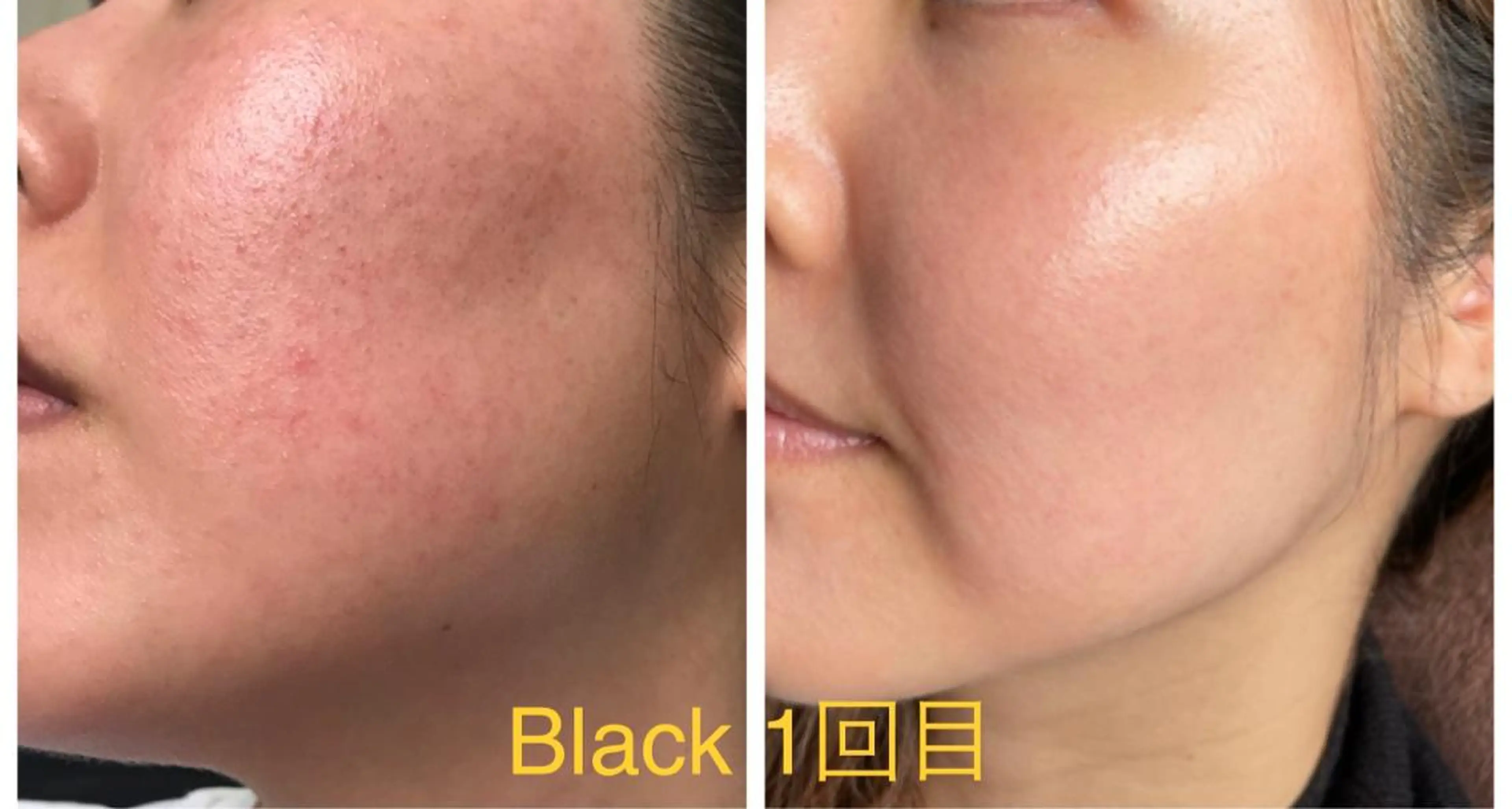 代表 MOMOのエステ・リラクイメージ