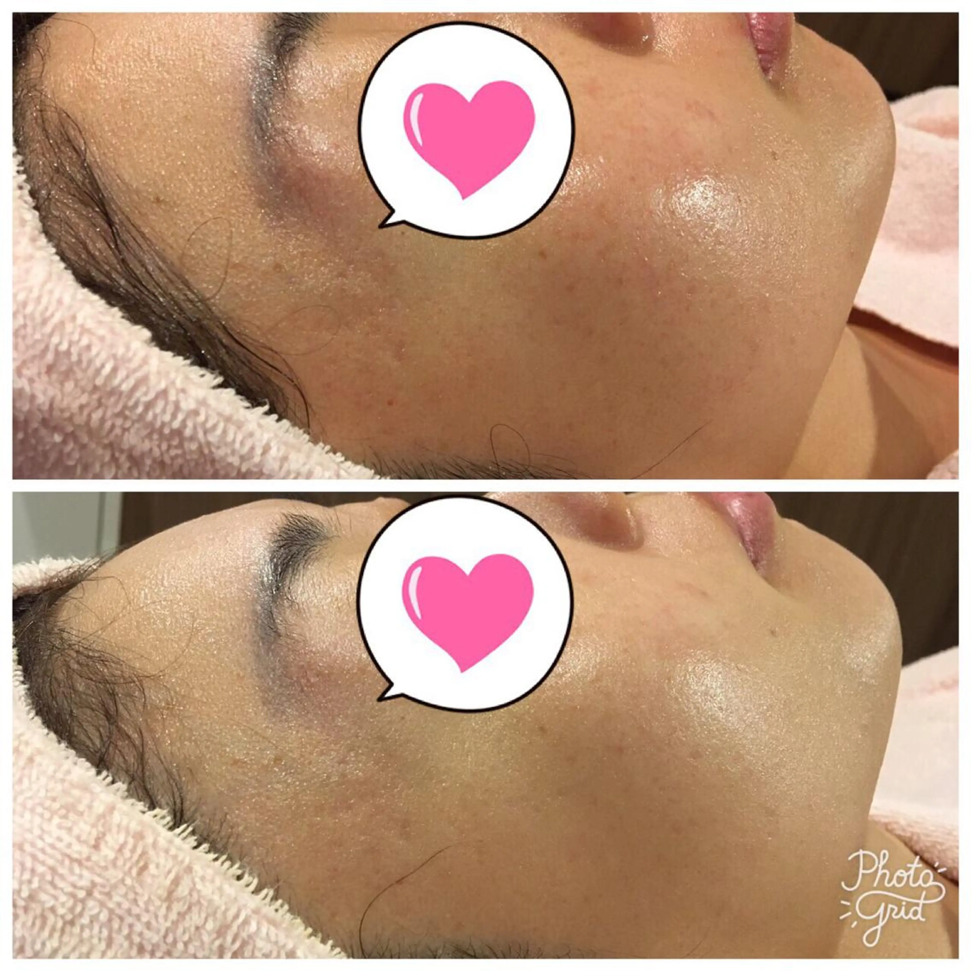 Une rencontre (ユヌ・ランコント)所属・つや肌専門店ユヌ・ ランコント中井のエステ・リラクイメージ