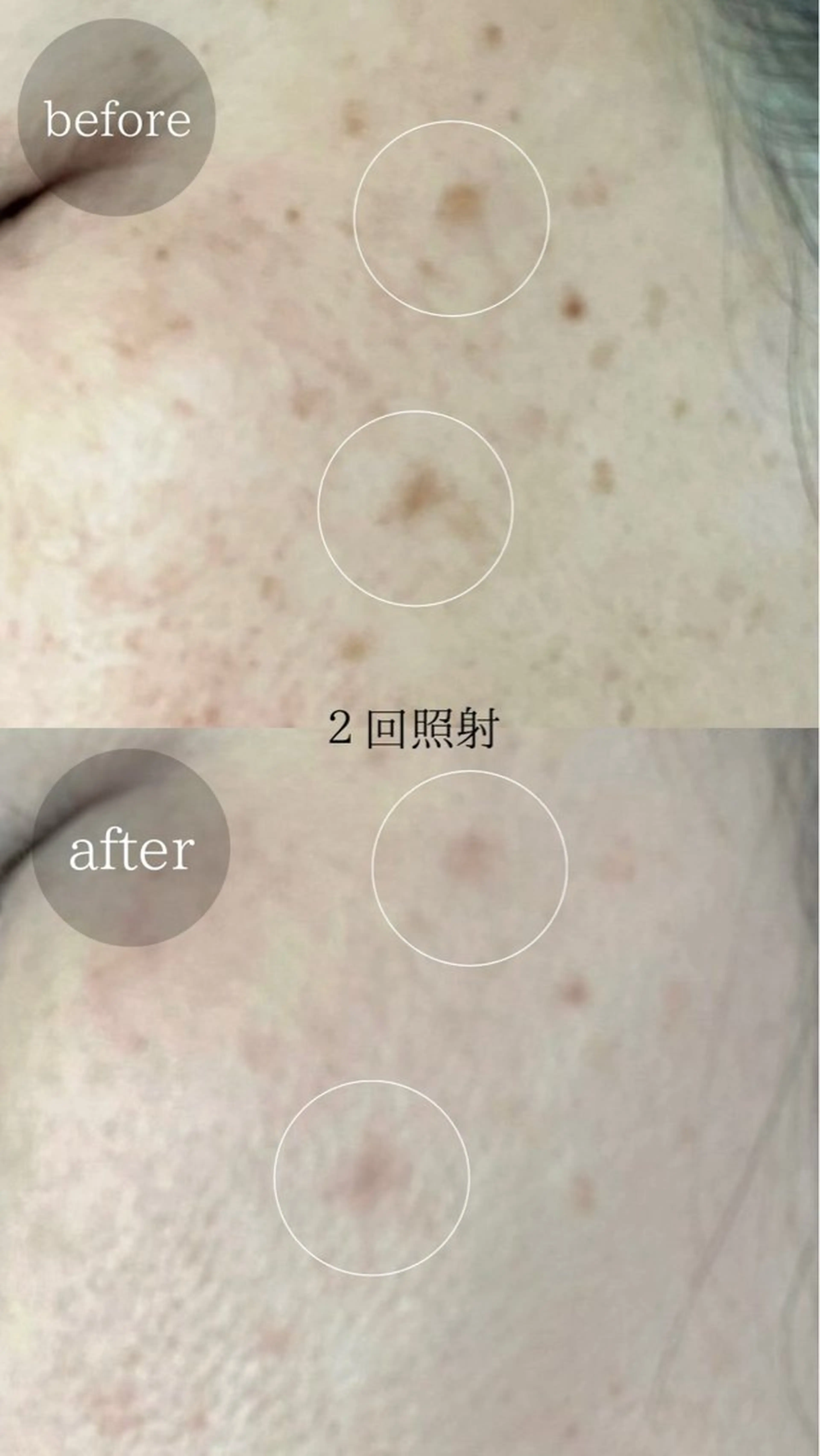 ＆epi 【エステ】のエステ・リラクイメージ