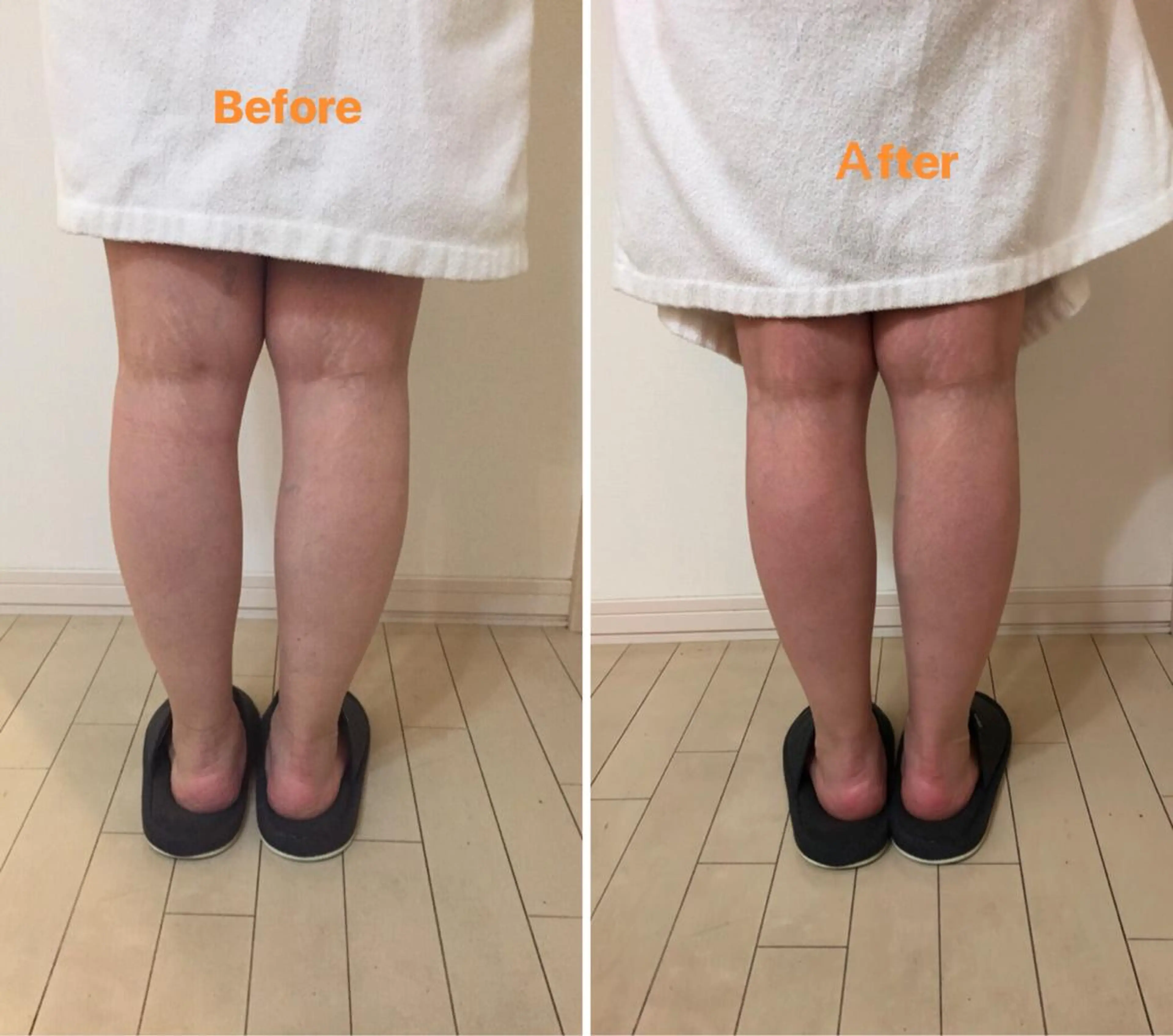 ミニモ限定骨盤調整リンパケア60分(フットバス、ハーブティ付き)の写真