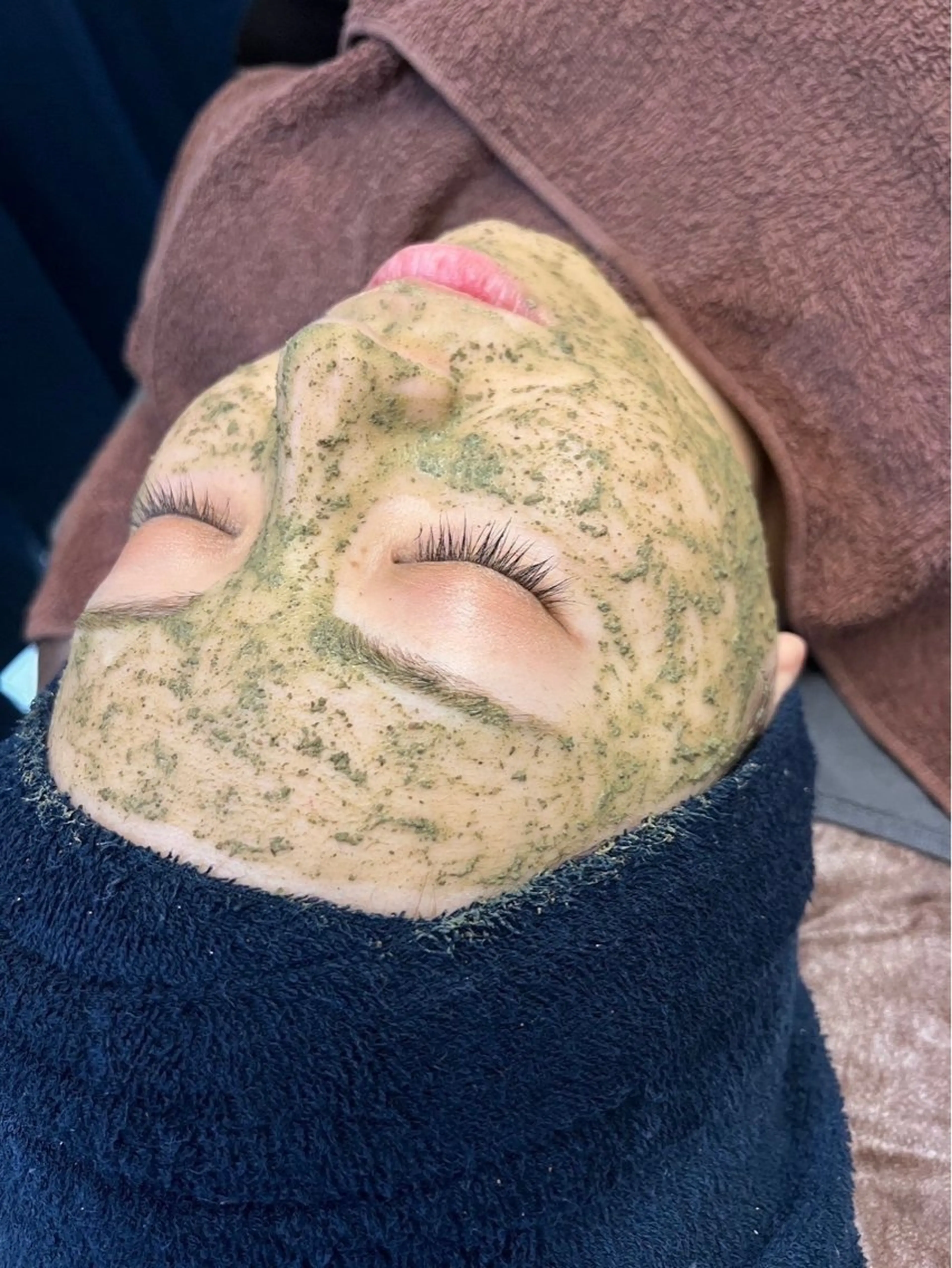 大人気!【ニキビケア】『剥けないハーブピーリング』ビタミンC+幹細胞美容液+毛穴洗浄🌿の写真