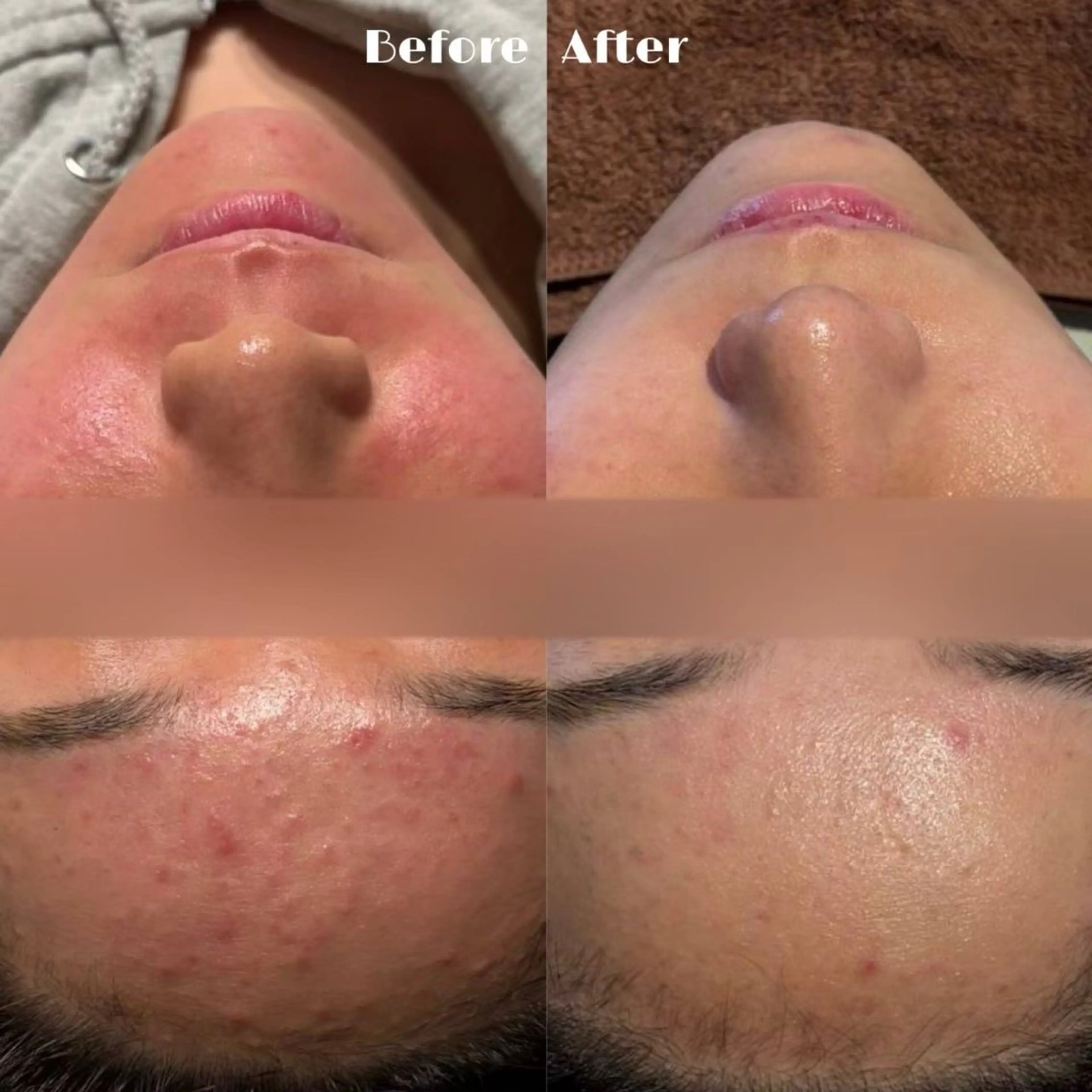 LUMIERE福岡春吉店所属・LUMIERE 福岡のエステ・リラクイメージ