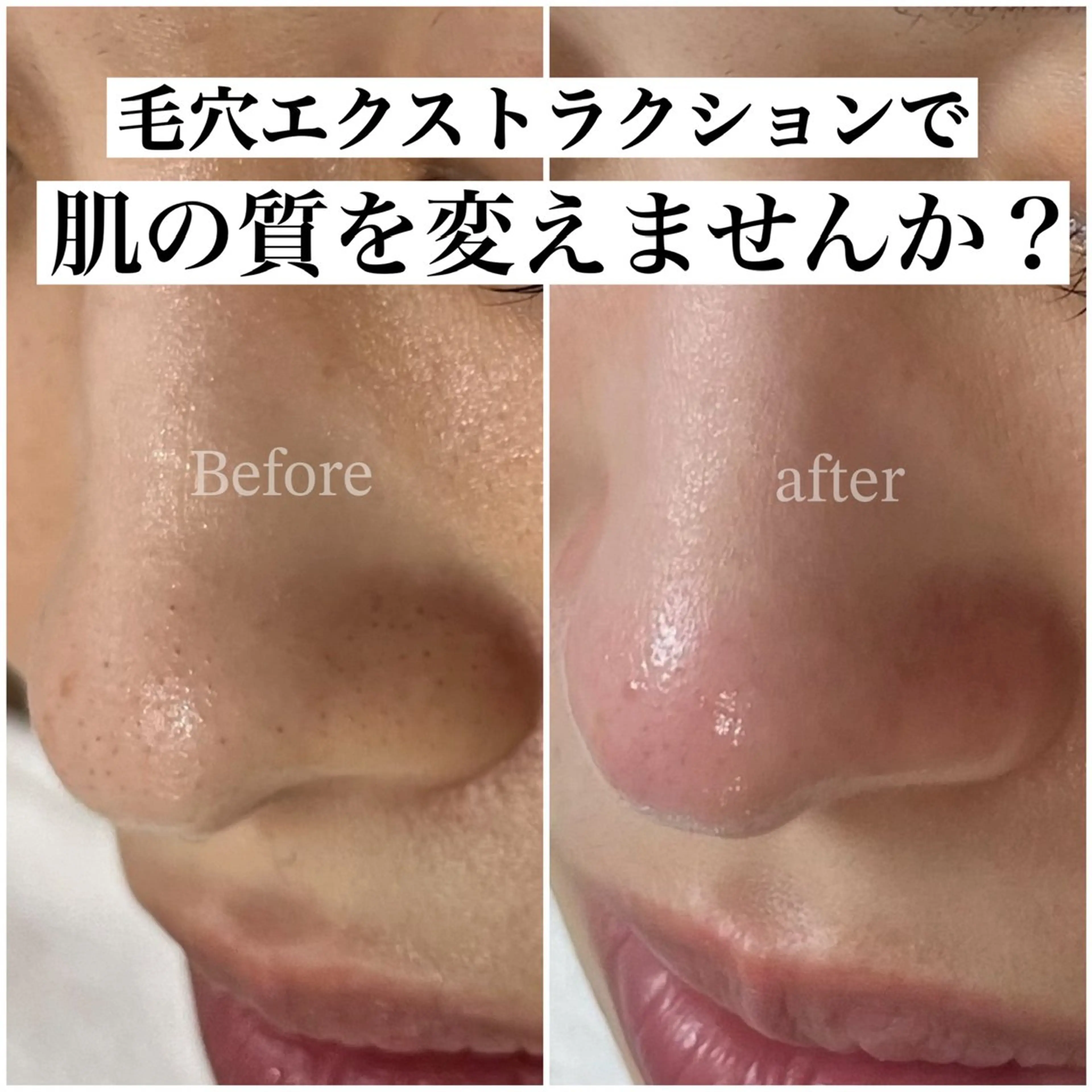 BELINDA HITOMIのマツエク・マツパデザイン