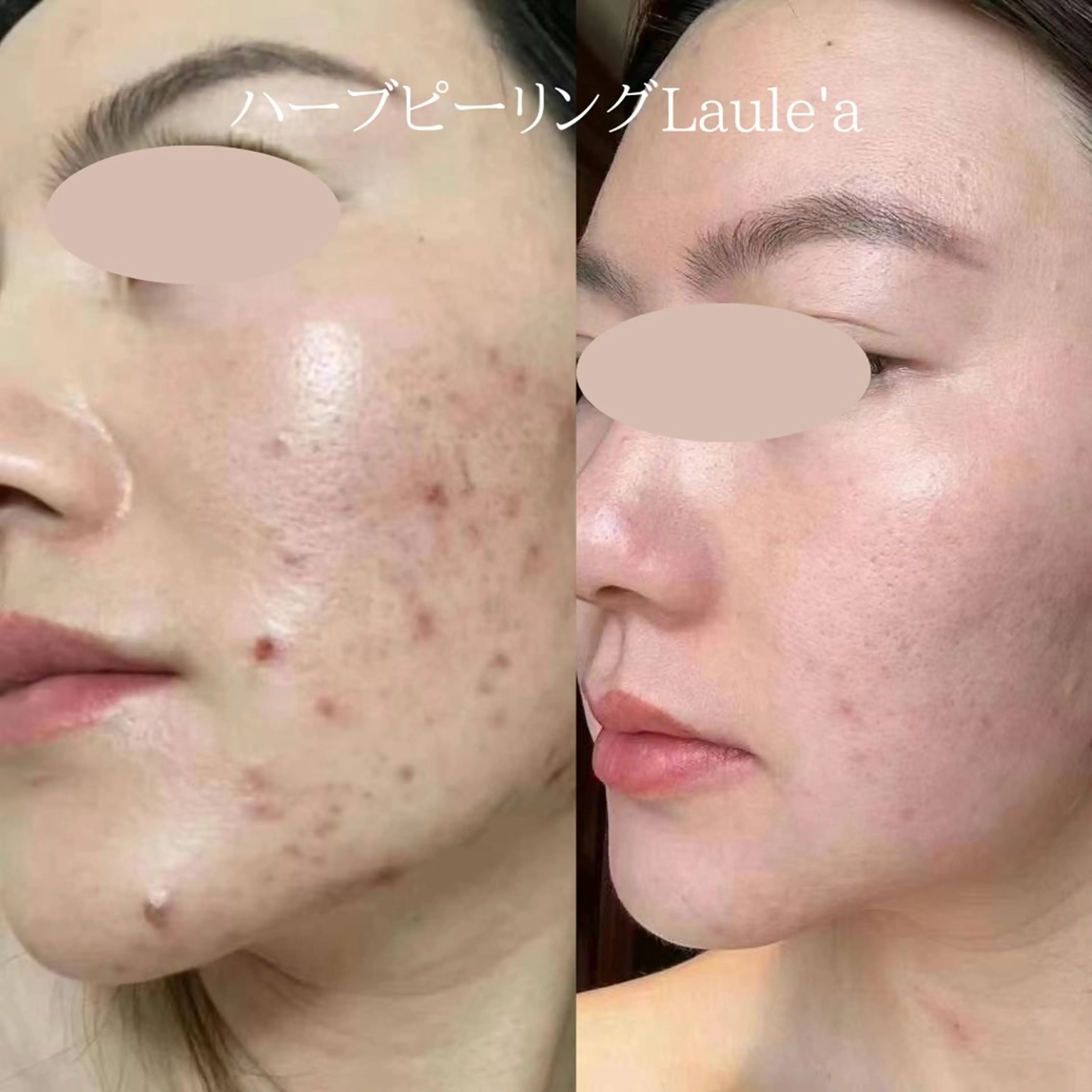 美腸サロン【腸もみ &アロマリンパ】のエステ・リラクイメージ