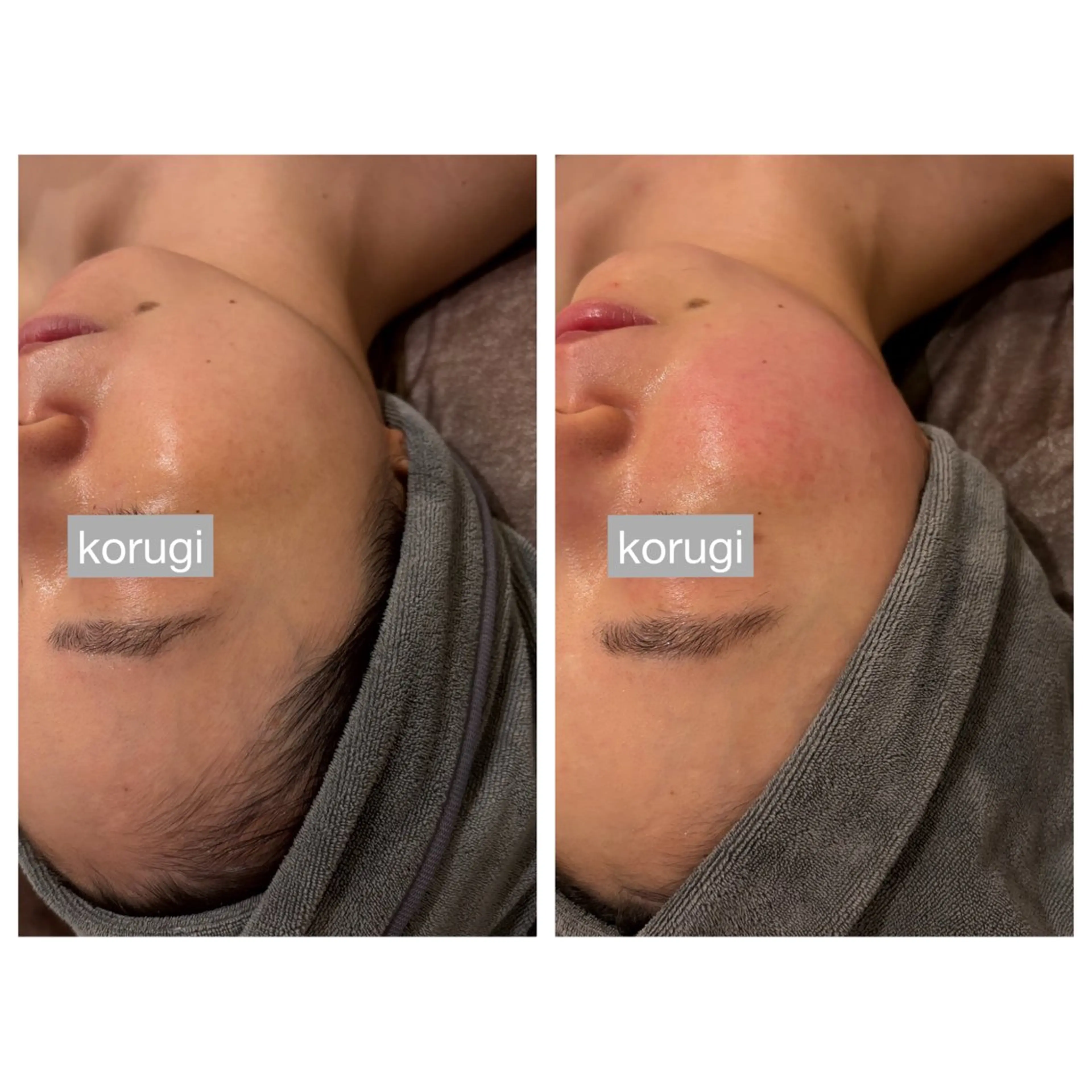 ☆痩身/小顔☆ コルギのエステ・リラクイメージ