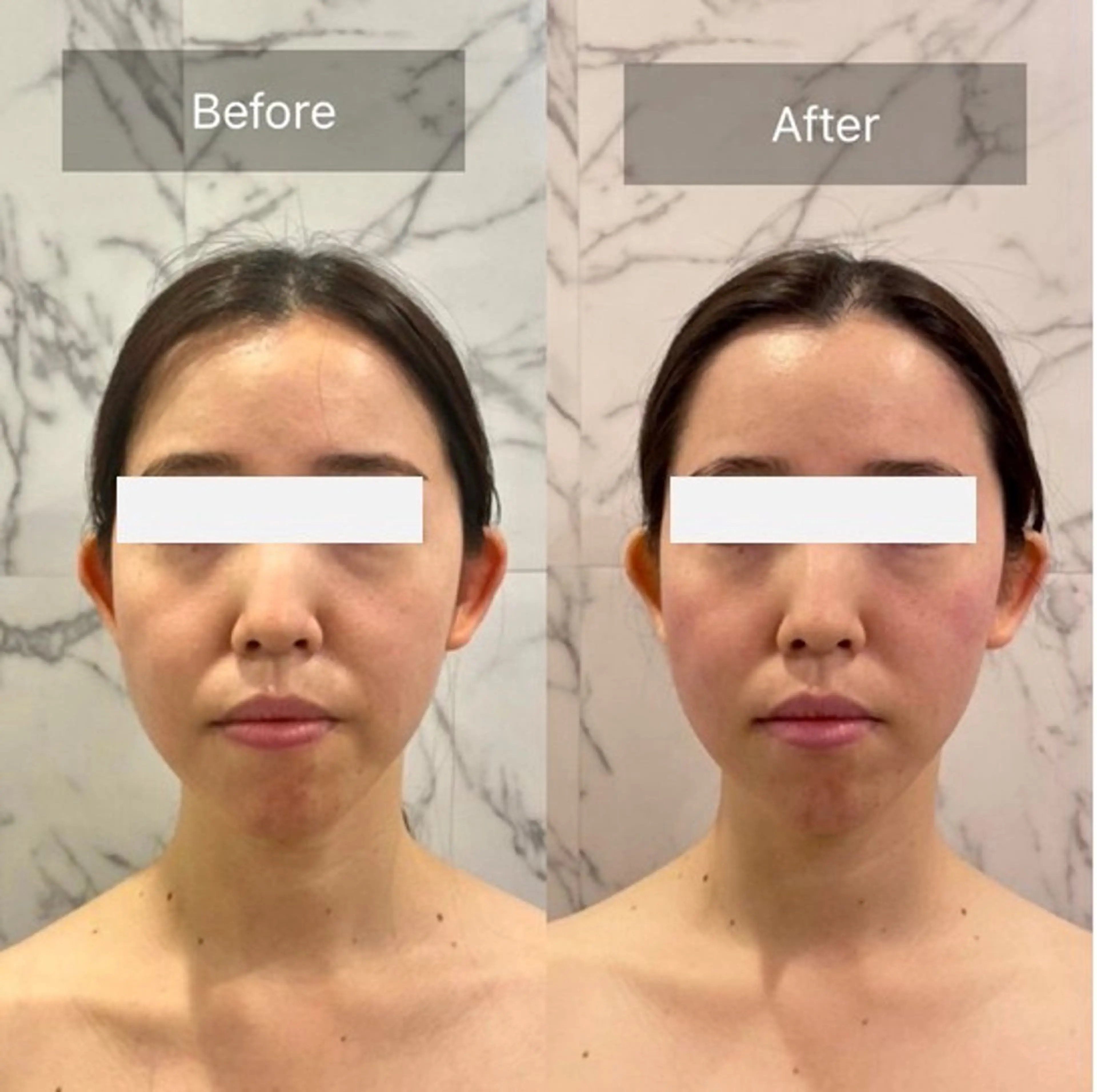 ASLI ARUS アスリアルースのエステ・リラクイメージ