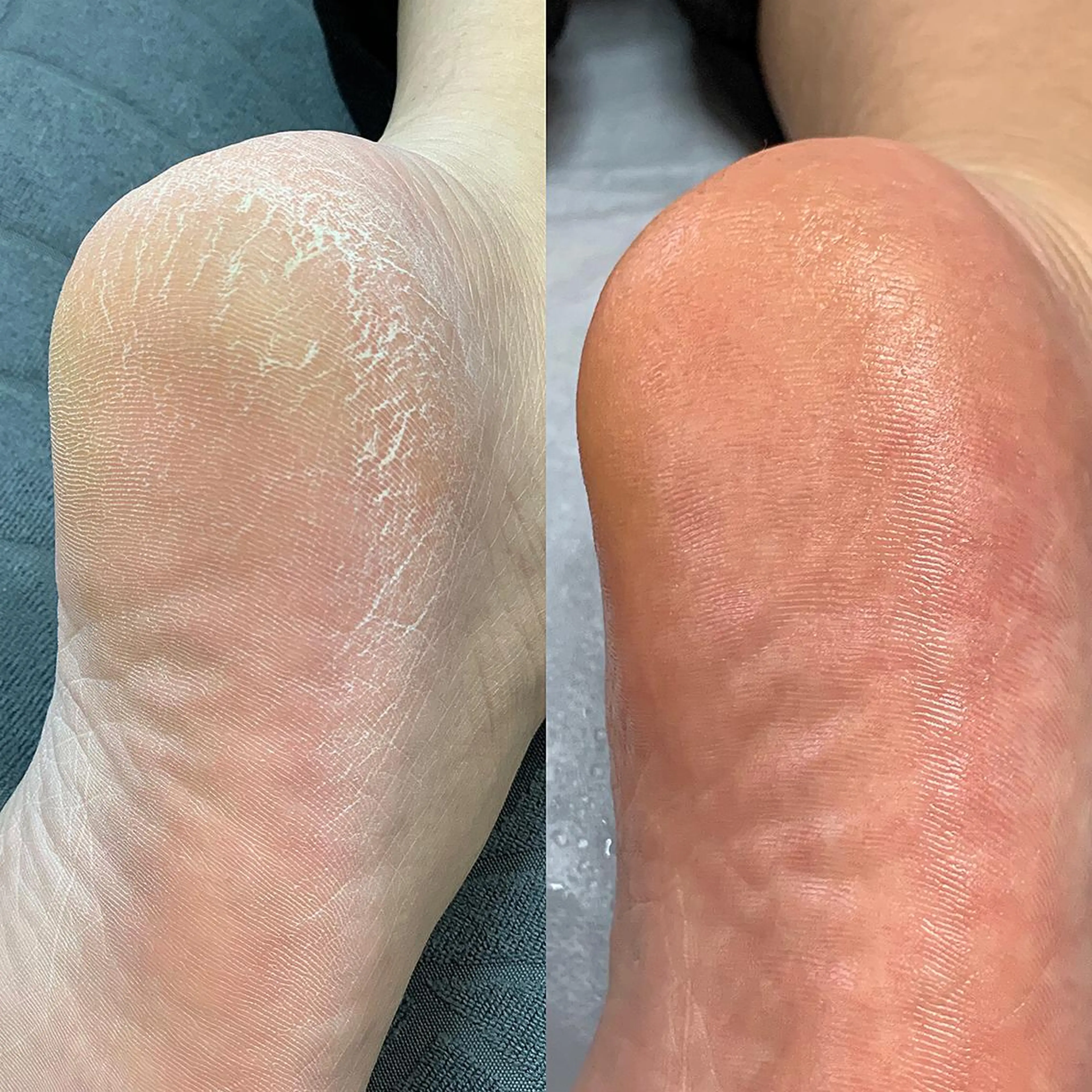 ネイル ラメ(グリッター) Takasaki Keikoのネイルデザイン