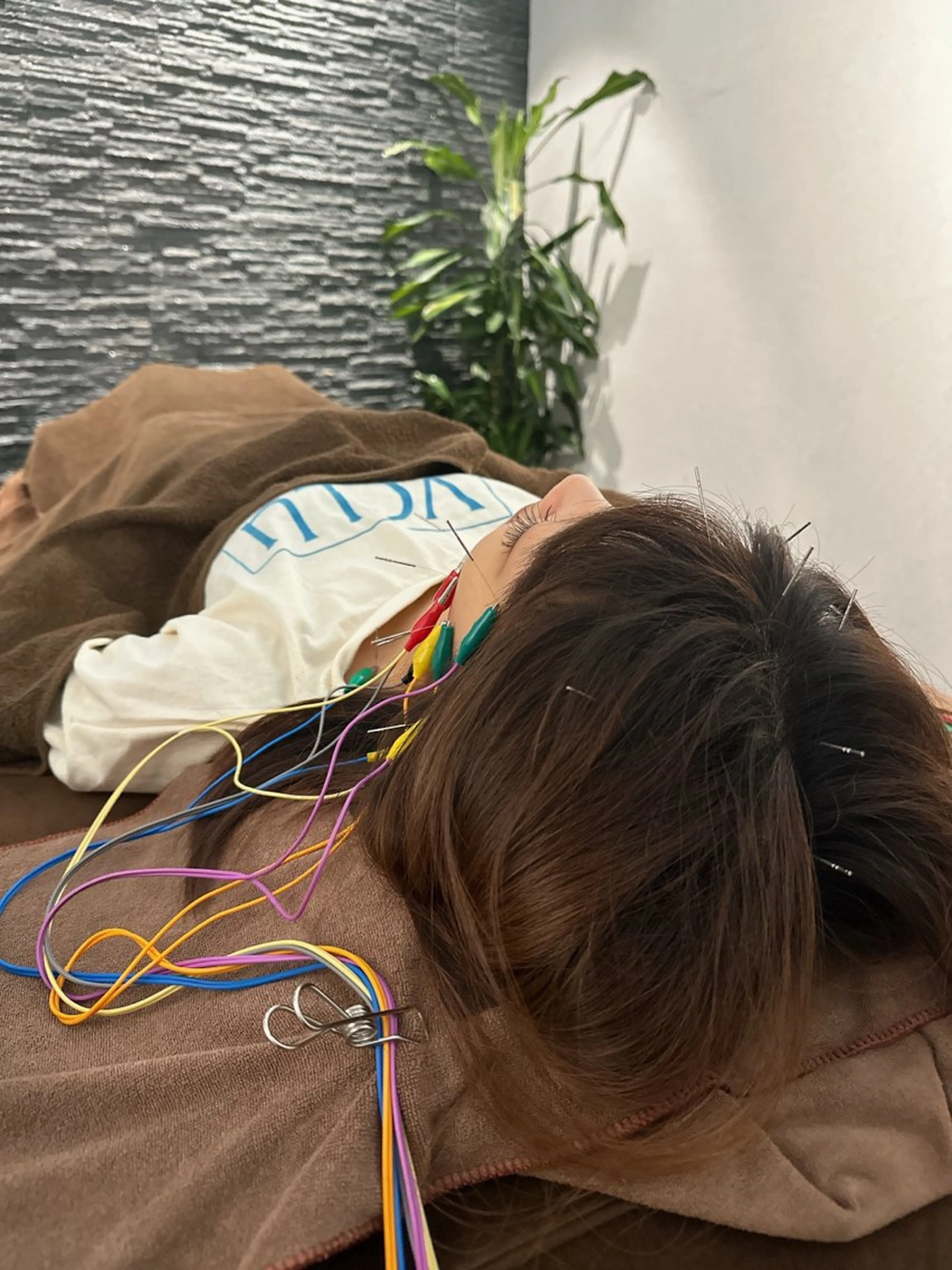 その他 美容鍼灸整体サロンBeauJu所属・小顔矯/美容鍼/鍼灸 BeauJuのその他イメージ