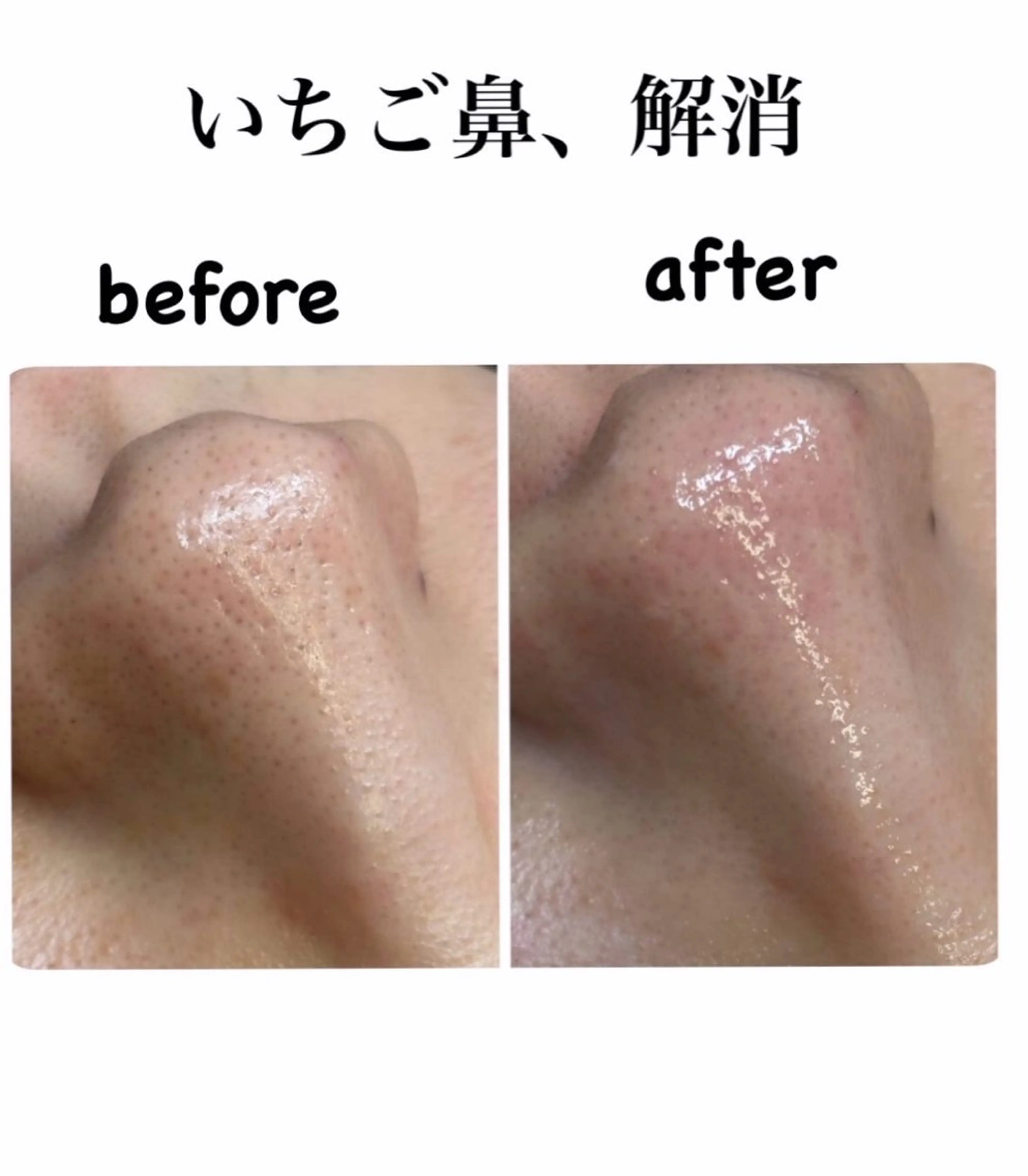 その他 Salon【yuzu.】所属・🍊肌管理×美眉 【yuzu.】の眉毛・アイブロウイメージ