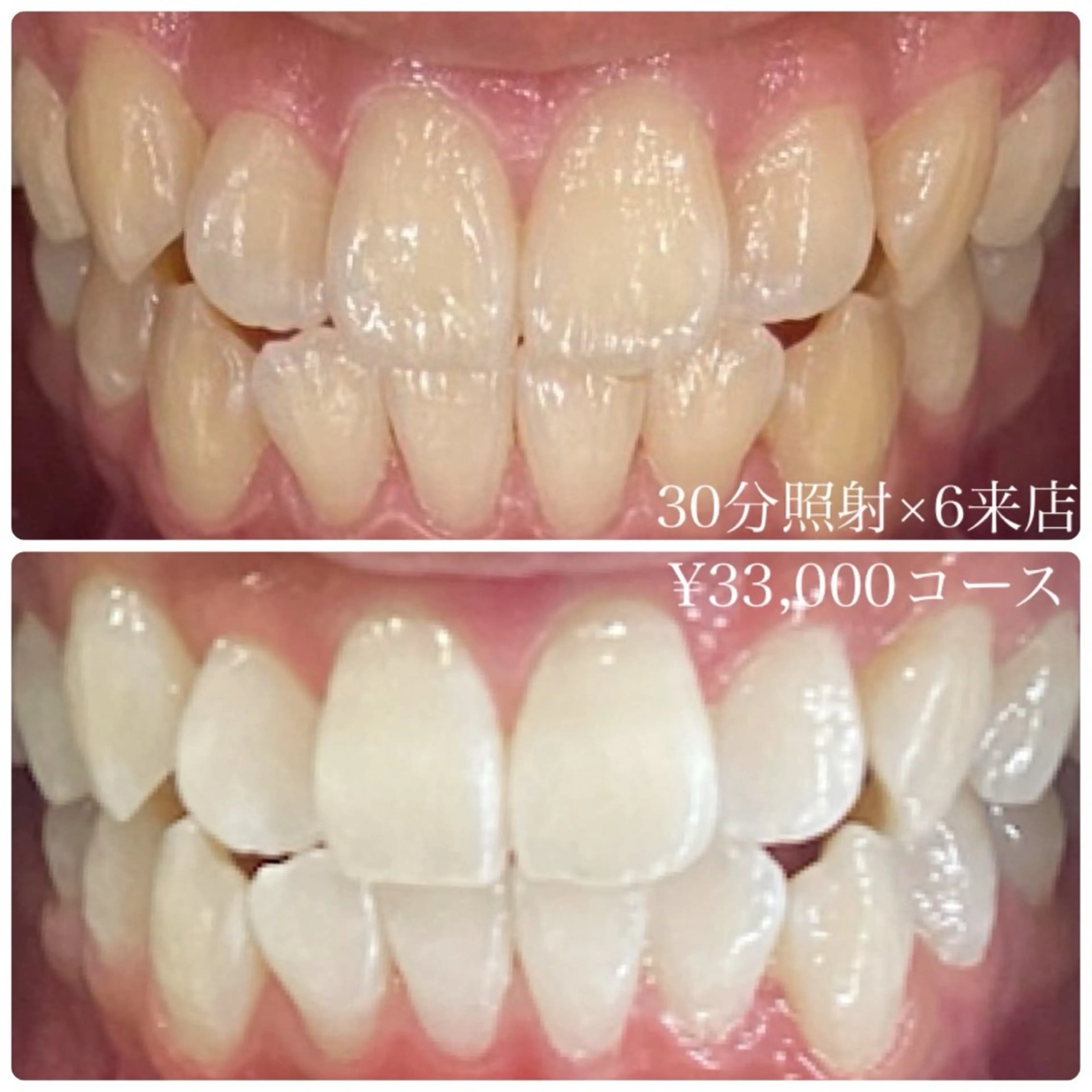 その他 PLATINUM Beauty 横浜店所属・ホワイトニングルーム 横浜店のその他イメージ