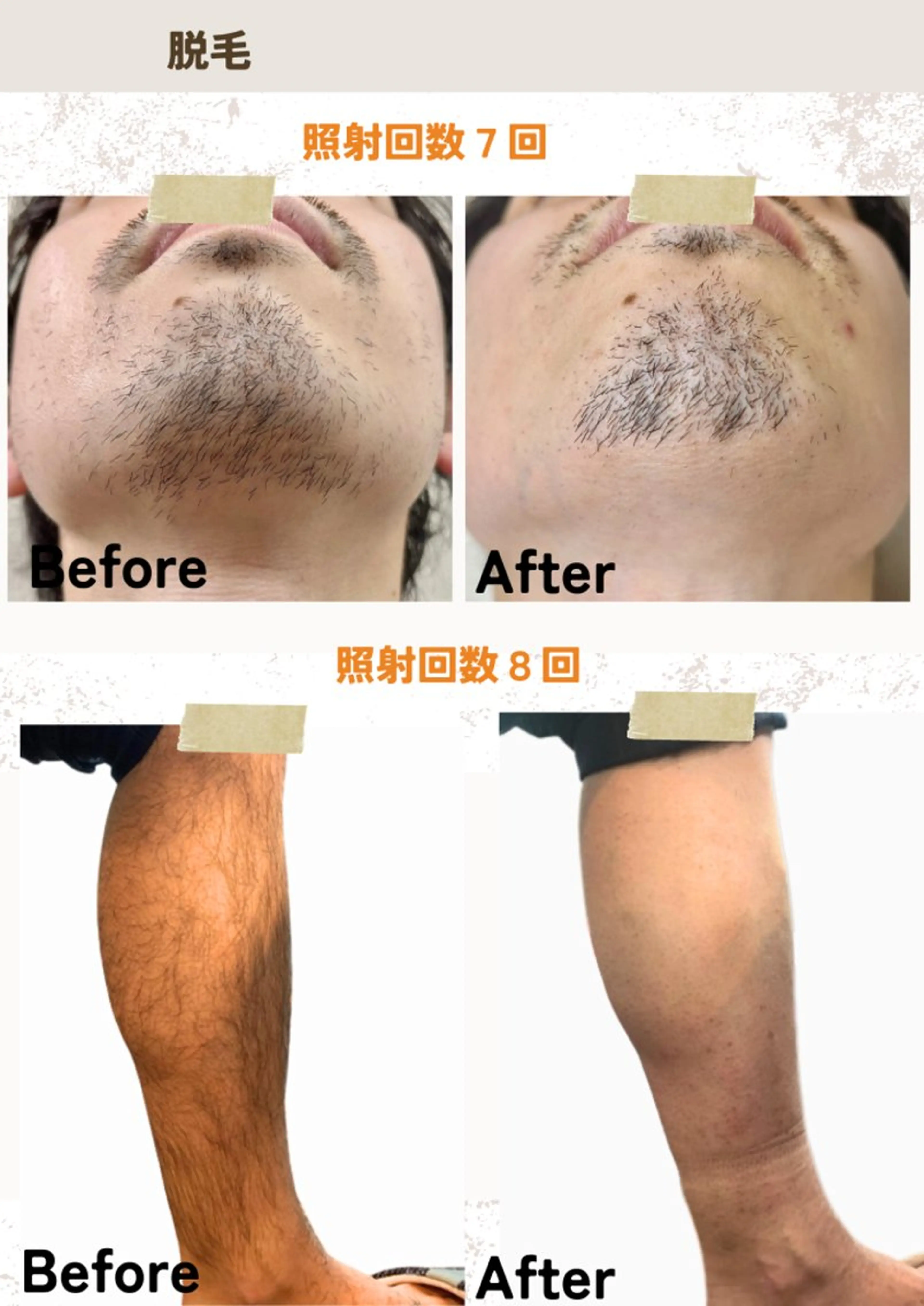 美ボディメイクサロン　only one body所属・所沢 痩身エステサロンのエステ・リラクイメージ