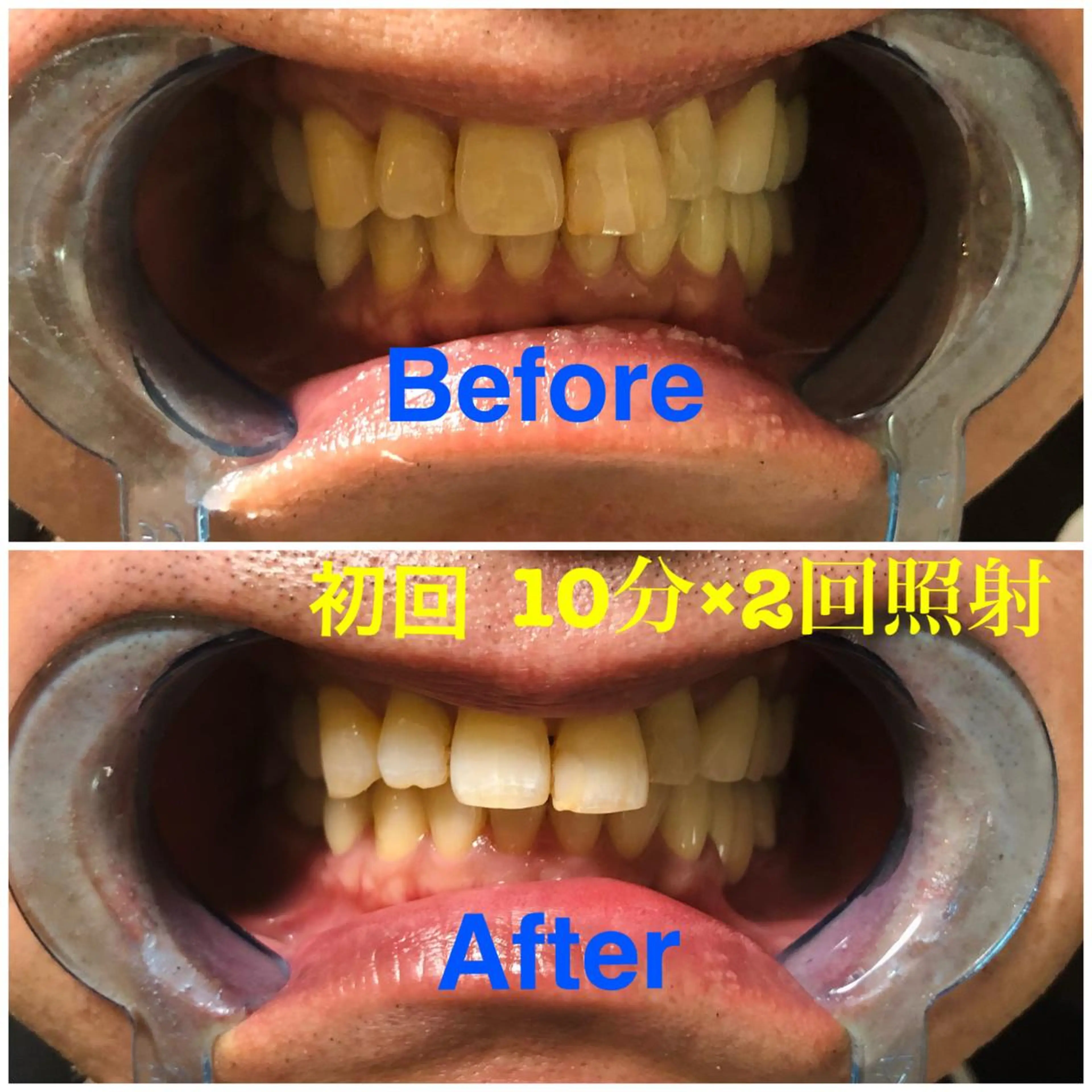 イーチブライト EachBrightのその他イメージ