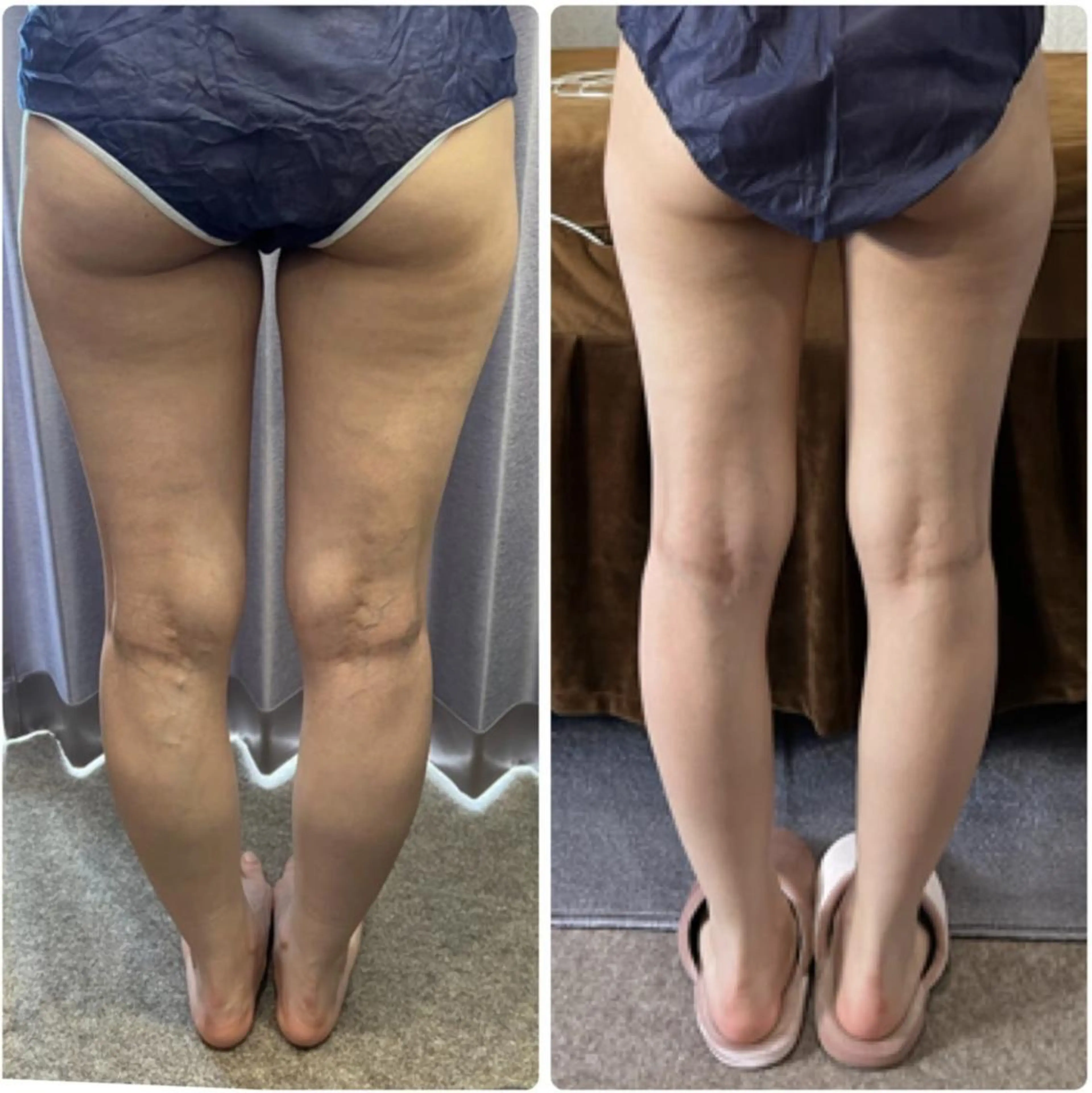 FLEUR大阪・美容 整体・痩身・小顔のエステ・リラクイメージ