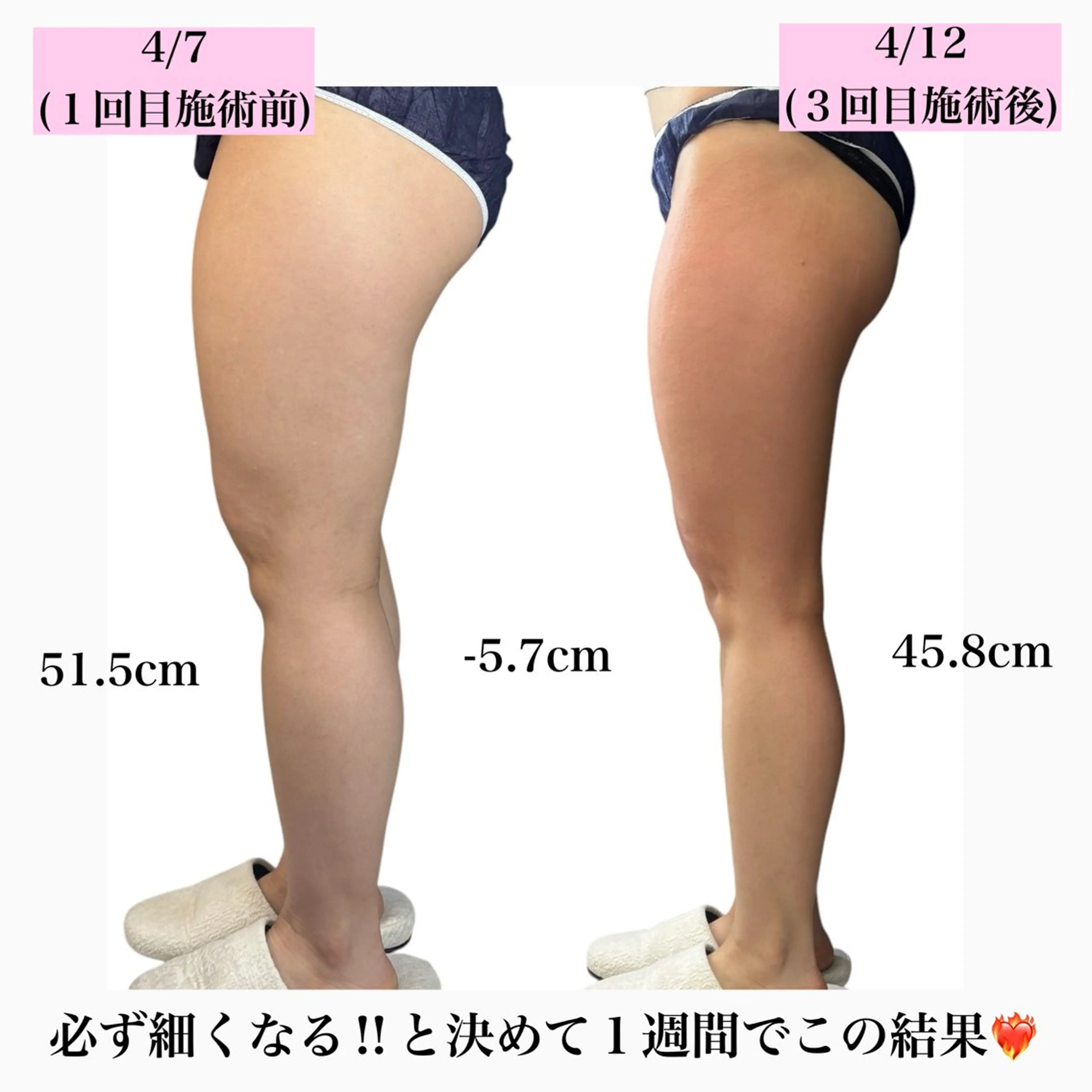 エステ Beauty SalonEclatのエステ・リラクイメージ