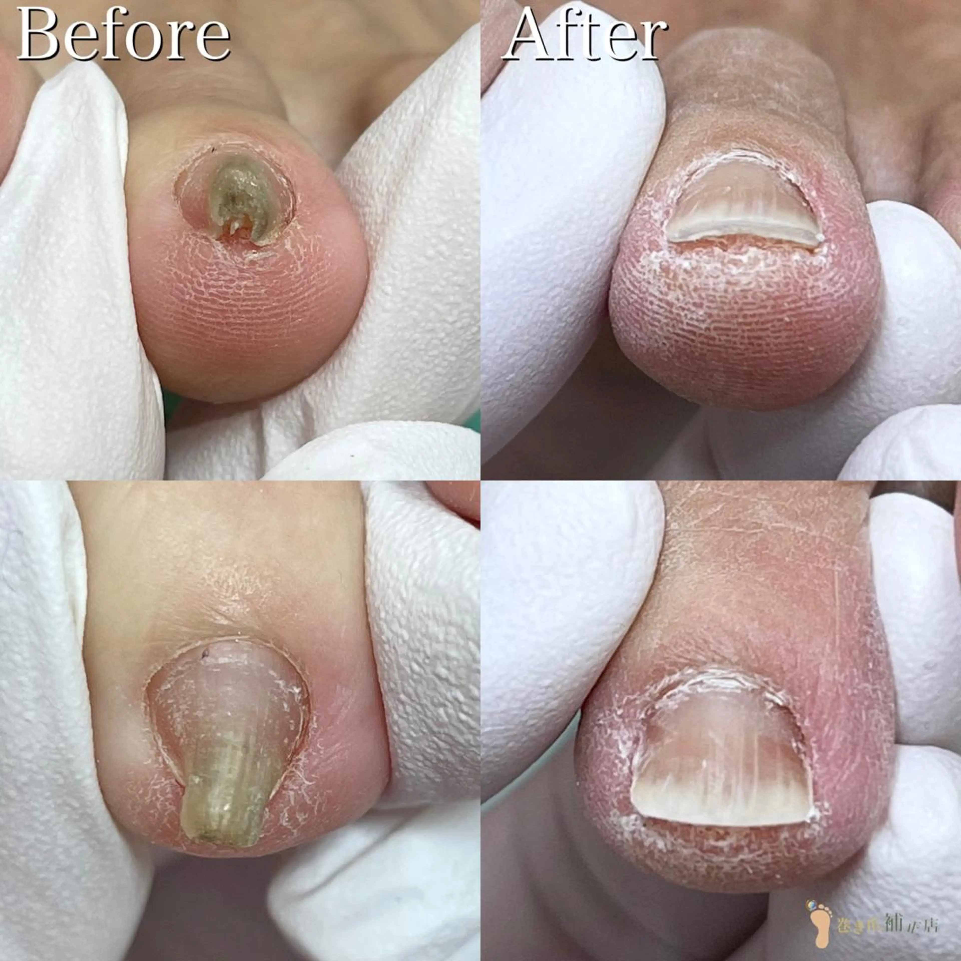 ネイル 東京巻き爪アカデミー所属・東京巻き爪 アカデミーのエステ・リラクイメージ