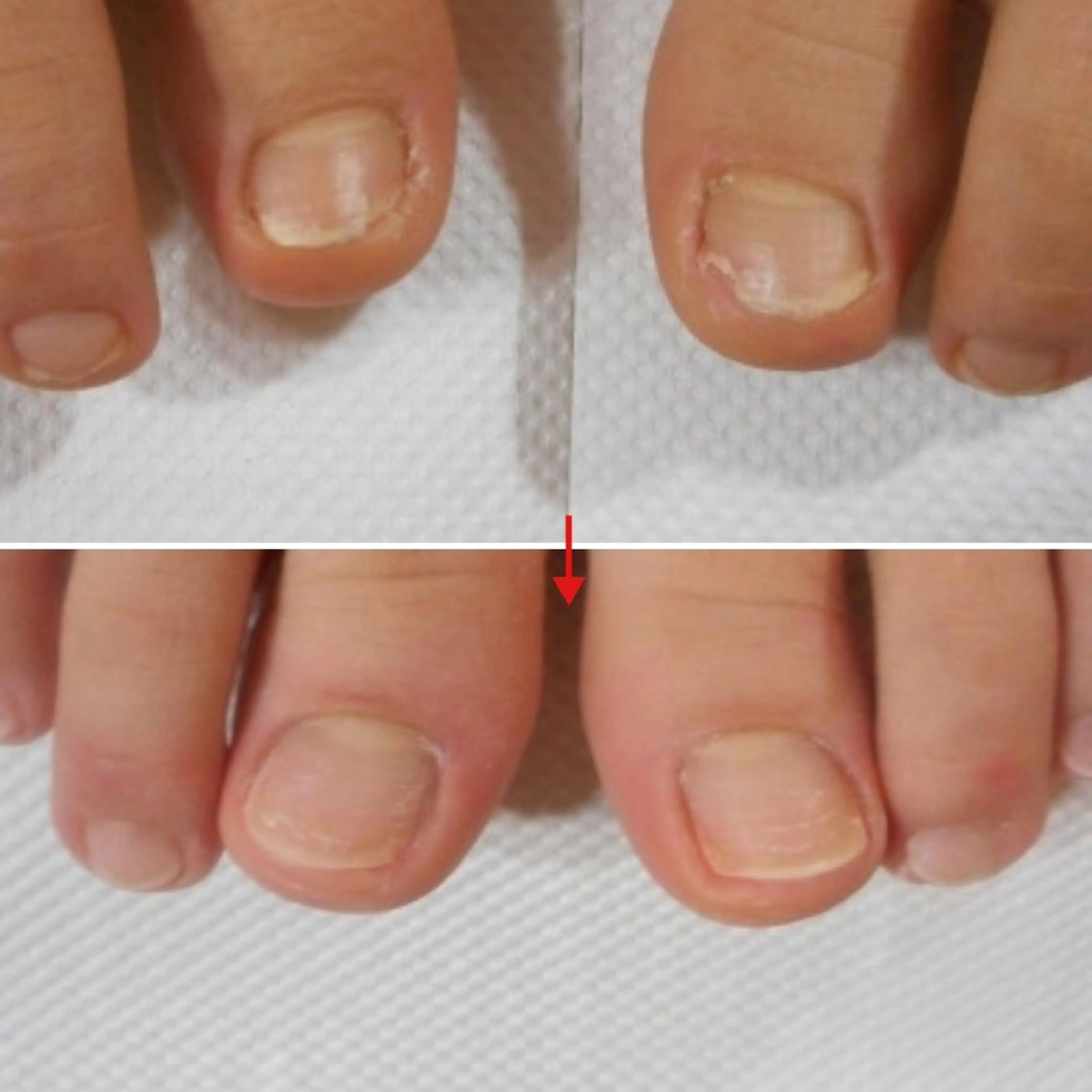 ネイル フットネイル ネイルサロンアリューム所属・ネイルサロン アリュームのネイルデザイン