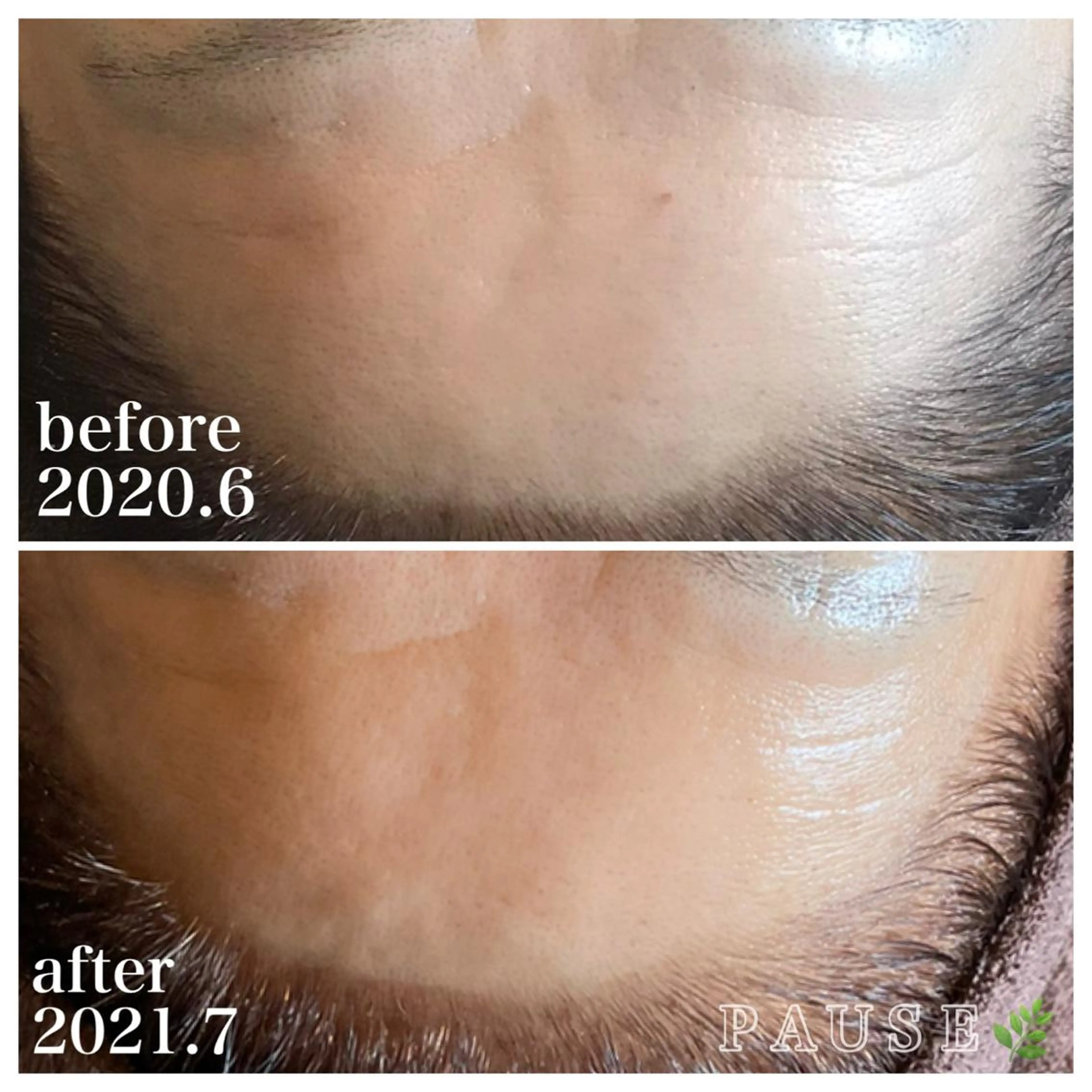 エステ 浜野 恵美のエステ・リラクイメージ