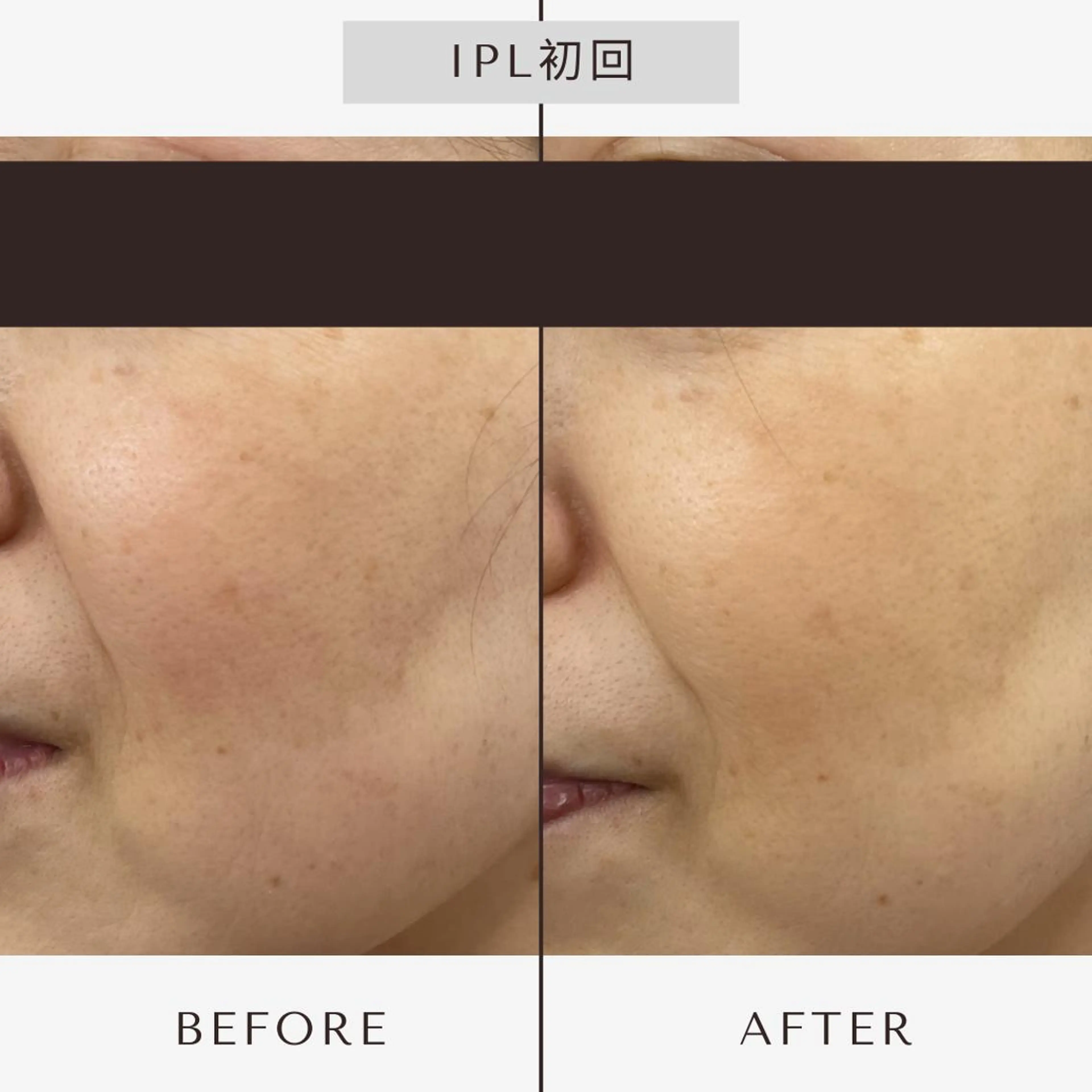 エステ リラク 【小顔・毛穴ケア】 セラピスト　和田紋子のエステ・リラクイメージ