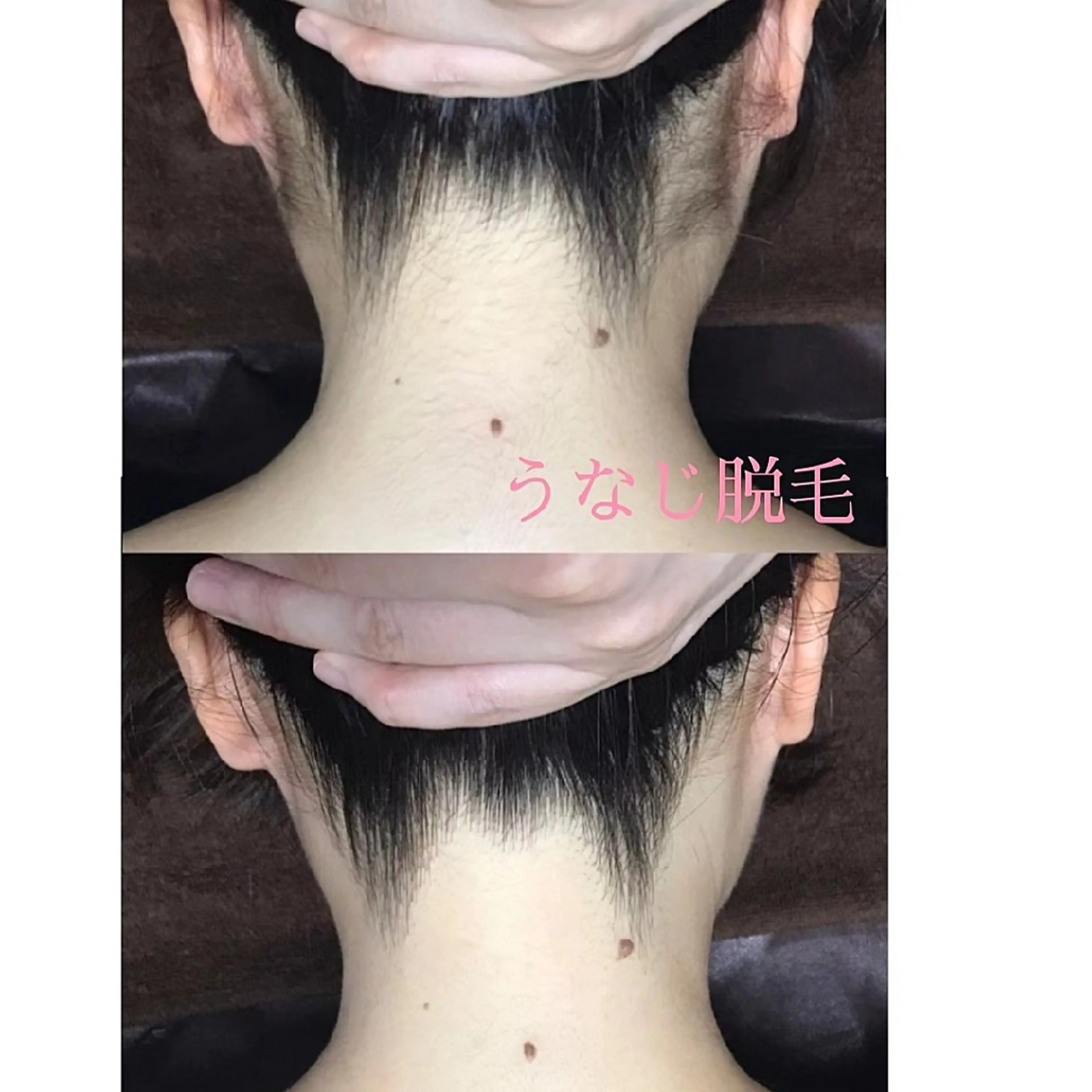 脱毛 河野 千恵のエステ・リラクイメージ