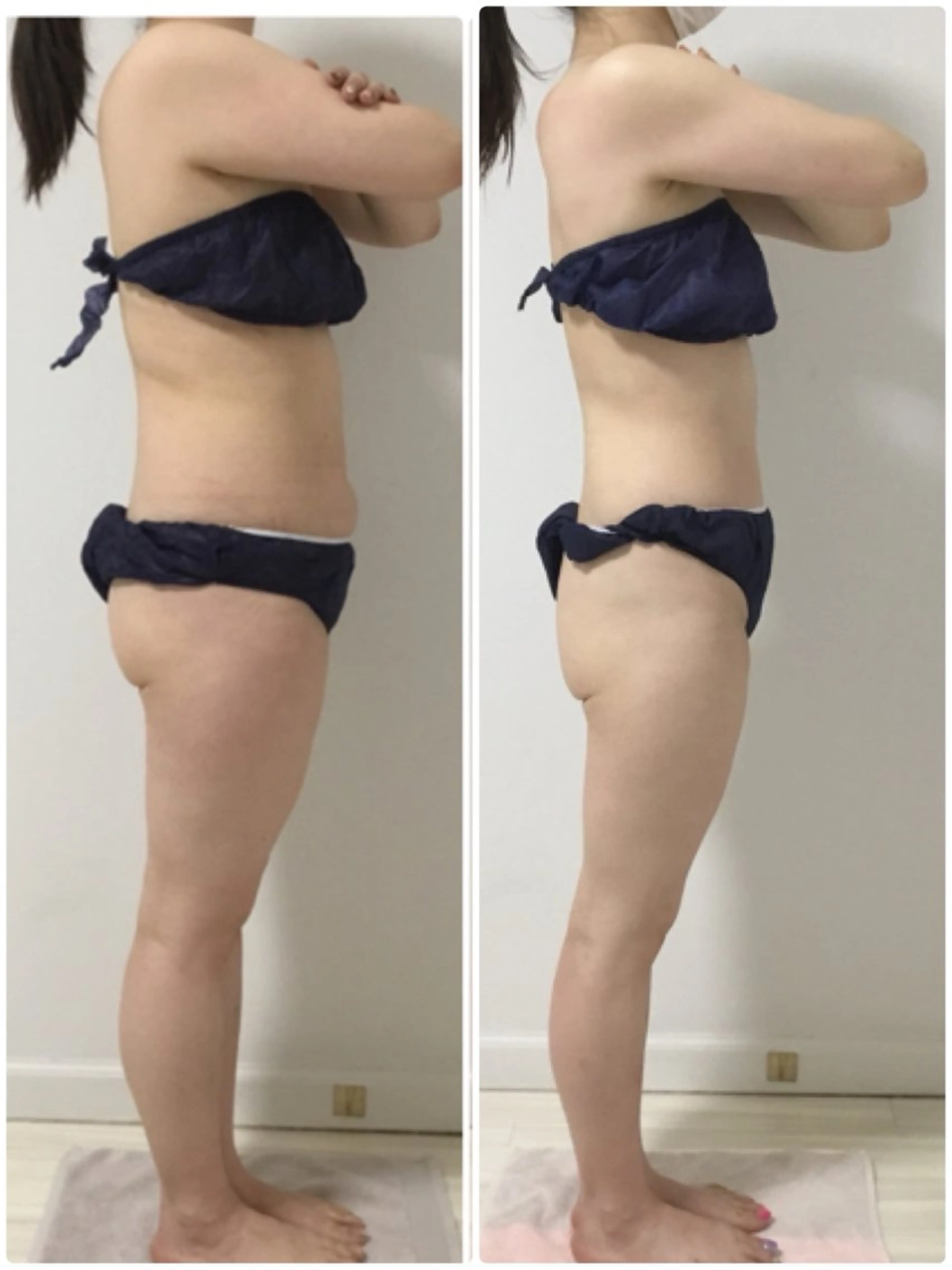 【結果重視🔥】強圧リンパ痩身90分✨ 全身セルケア×脂肪大掃除で即効スッキリ感を実感◎の写真