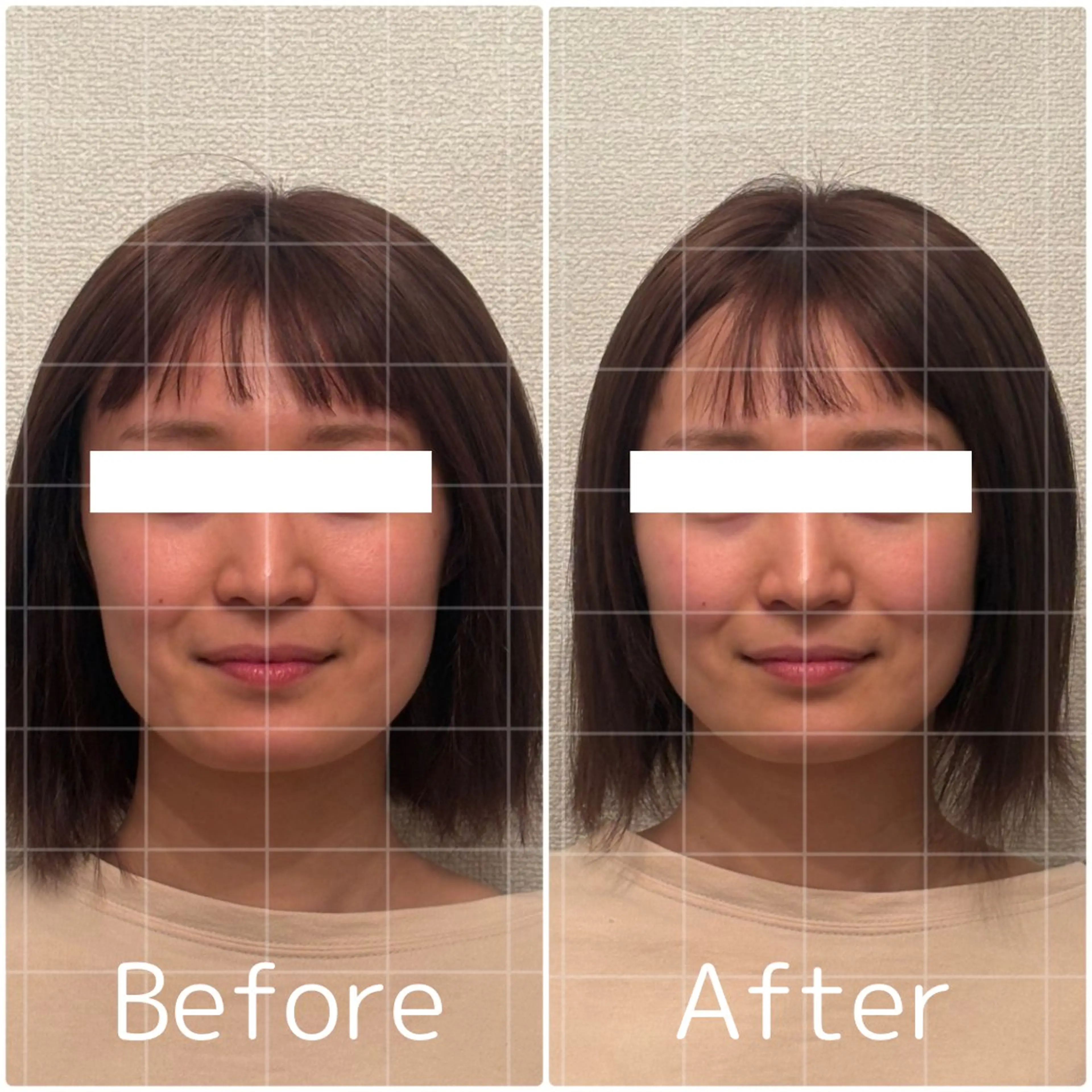 Lily luce 美骨小顔矯正のその他イメージ