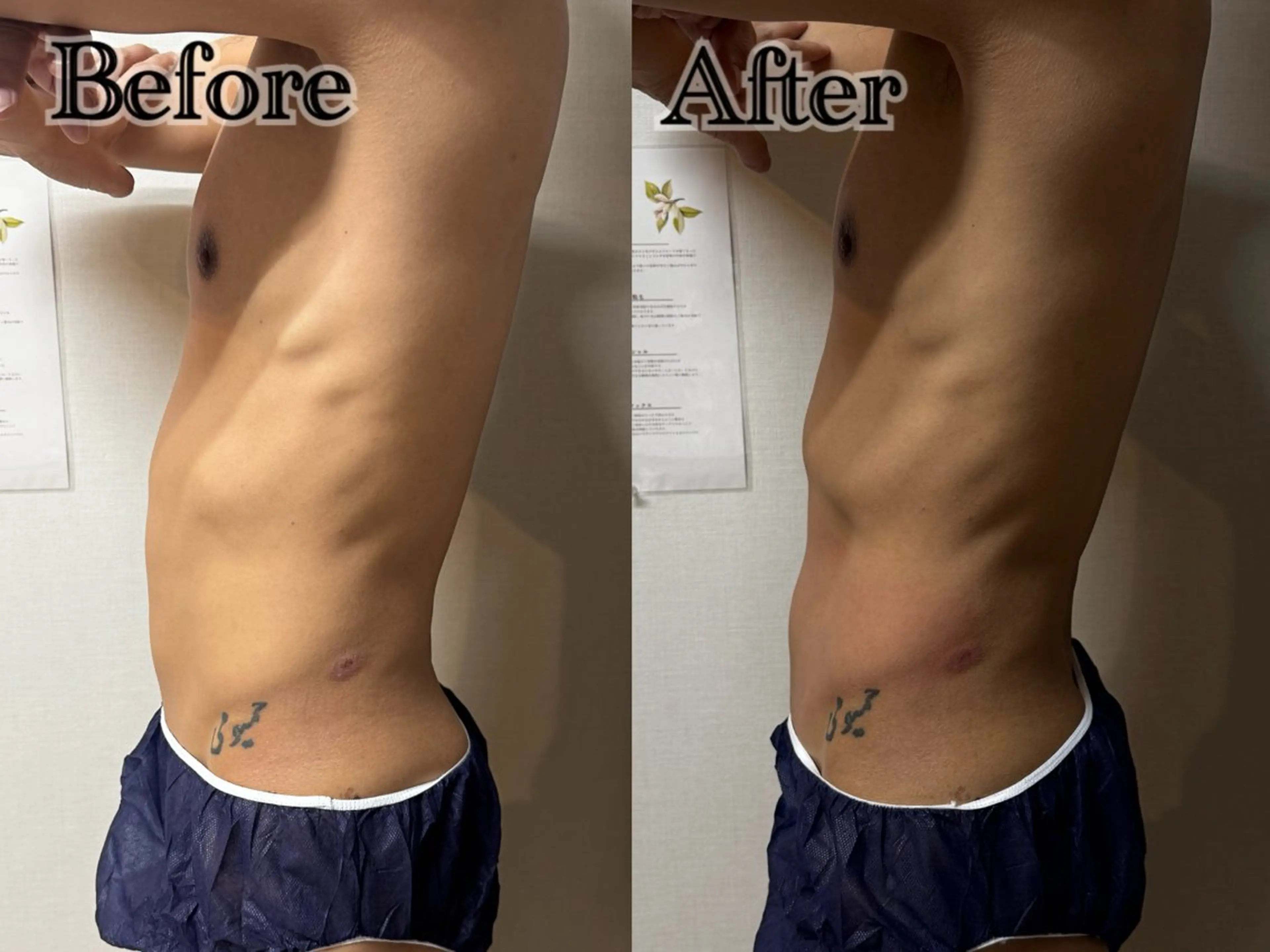 エステ 六本木脱毛andS 店長Sachiのエステ・リラクイメージ