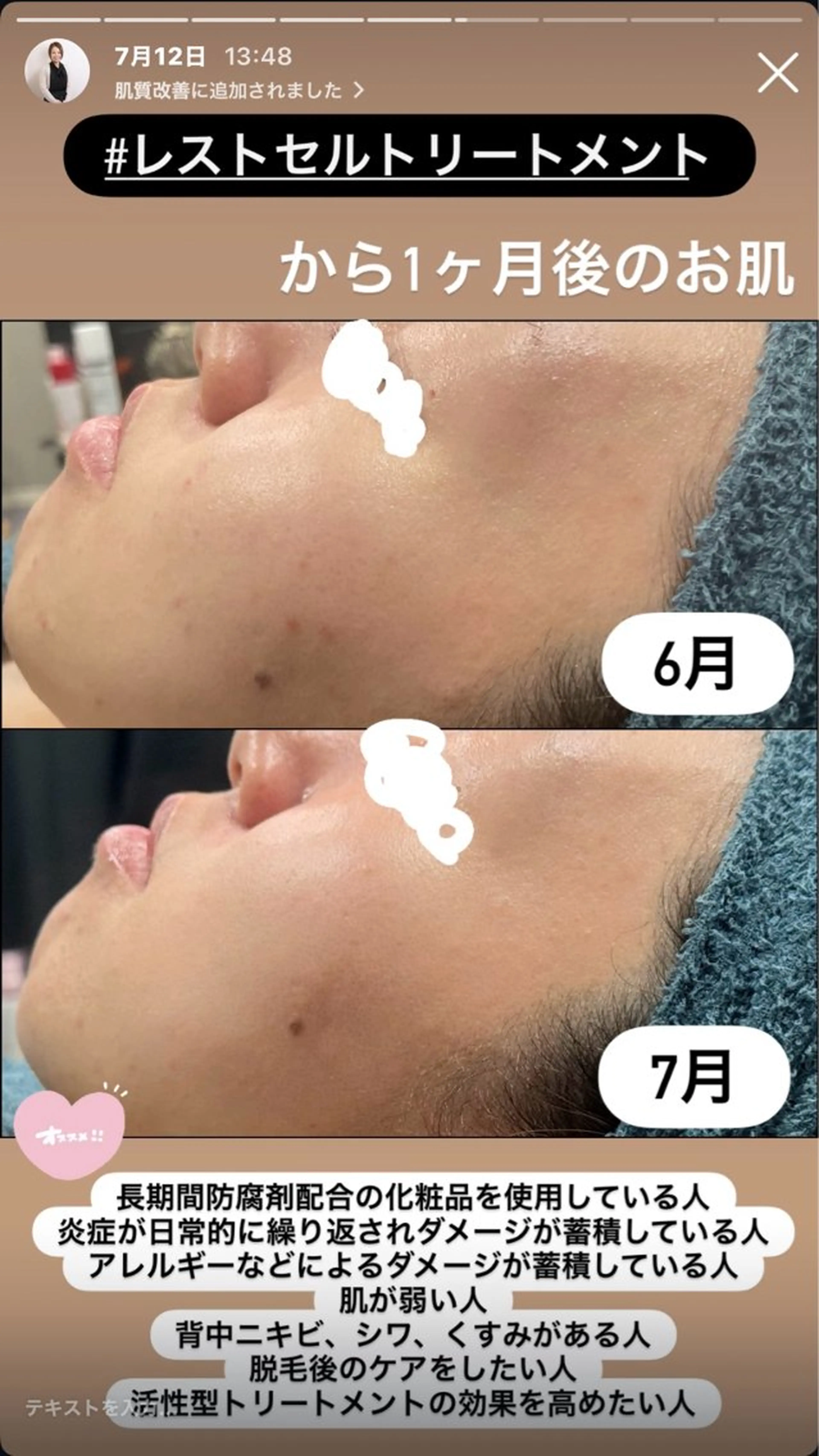 エステ LiZA エステティックサロンのエステ・リラクイメージ