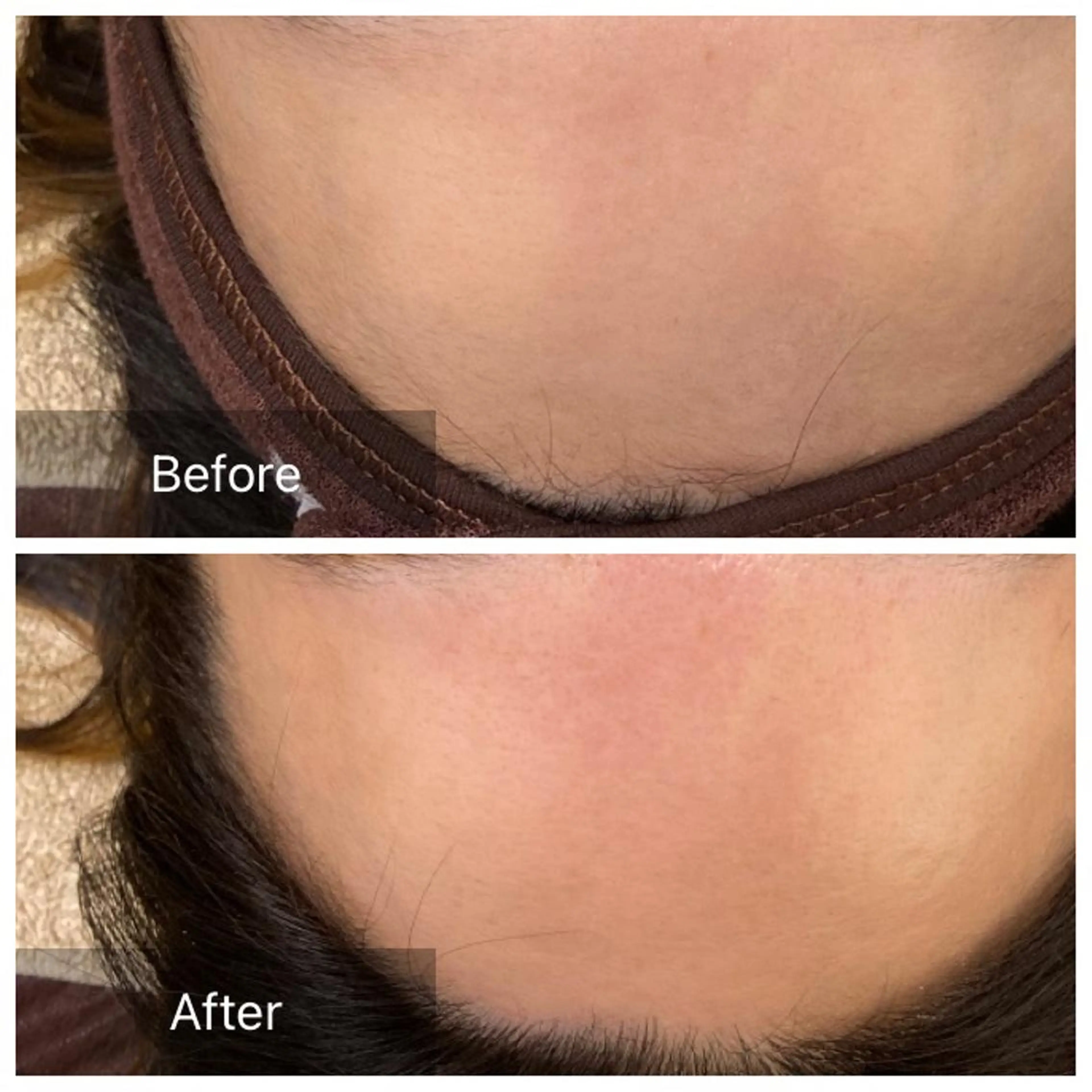 脱毛 産毛専門店 Bittoのエステ・リラクイメージ