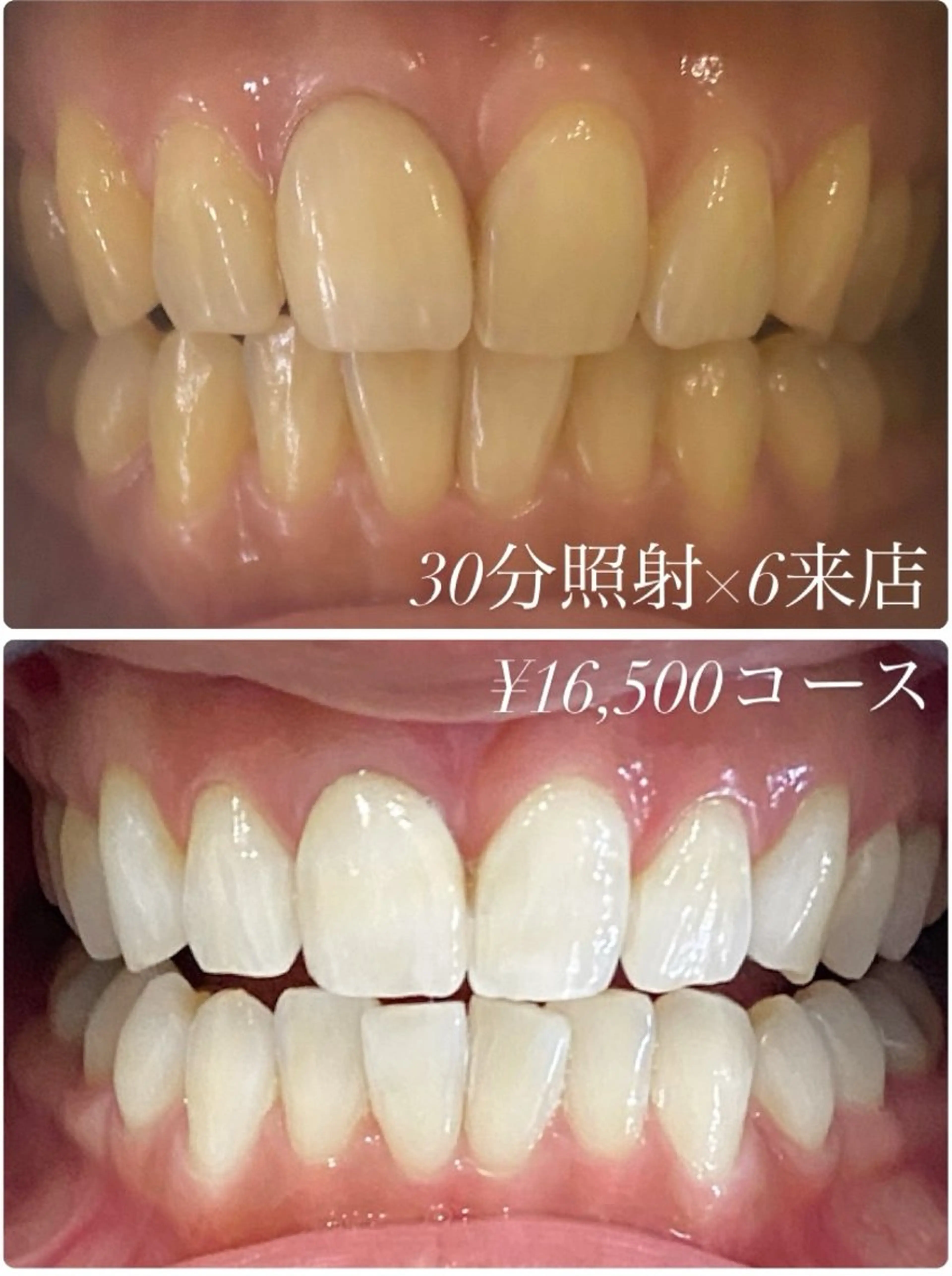 その他 ホワイトニングルーム　川崎店所属・ホワイトニング ルーム　川崎店のその他イメージ