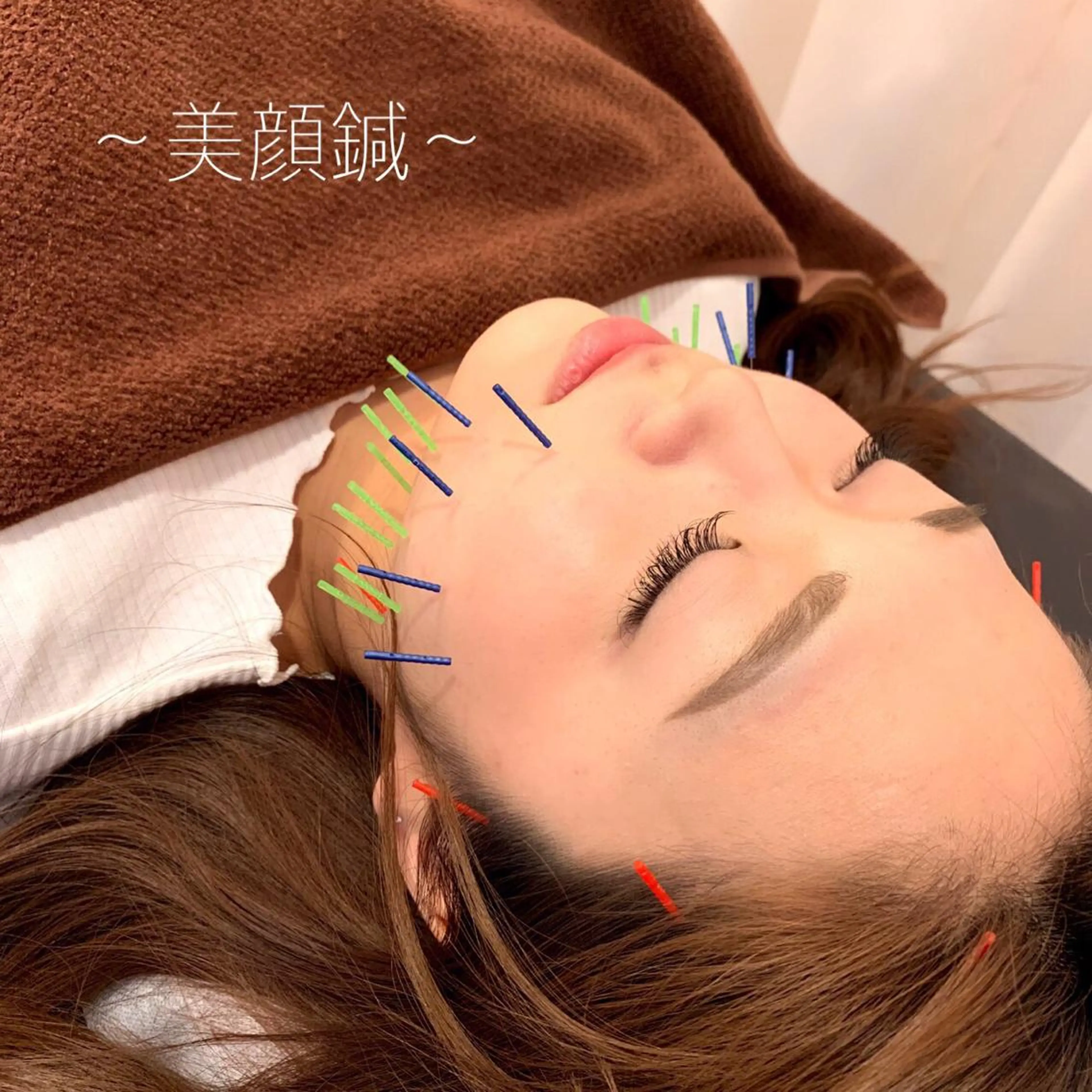 表参道鍼灸院K 美容鍼🔮ララピールのエステ・リラクイメージ