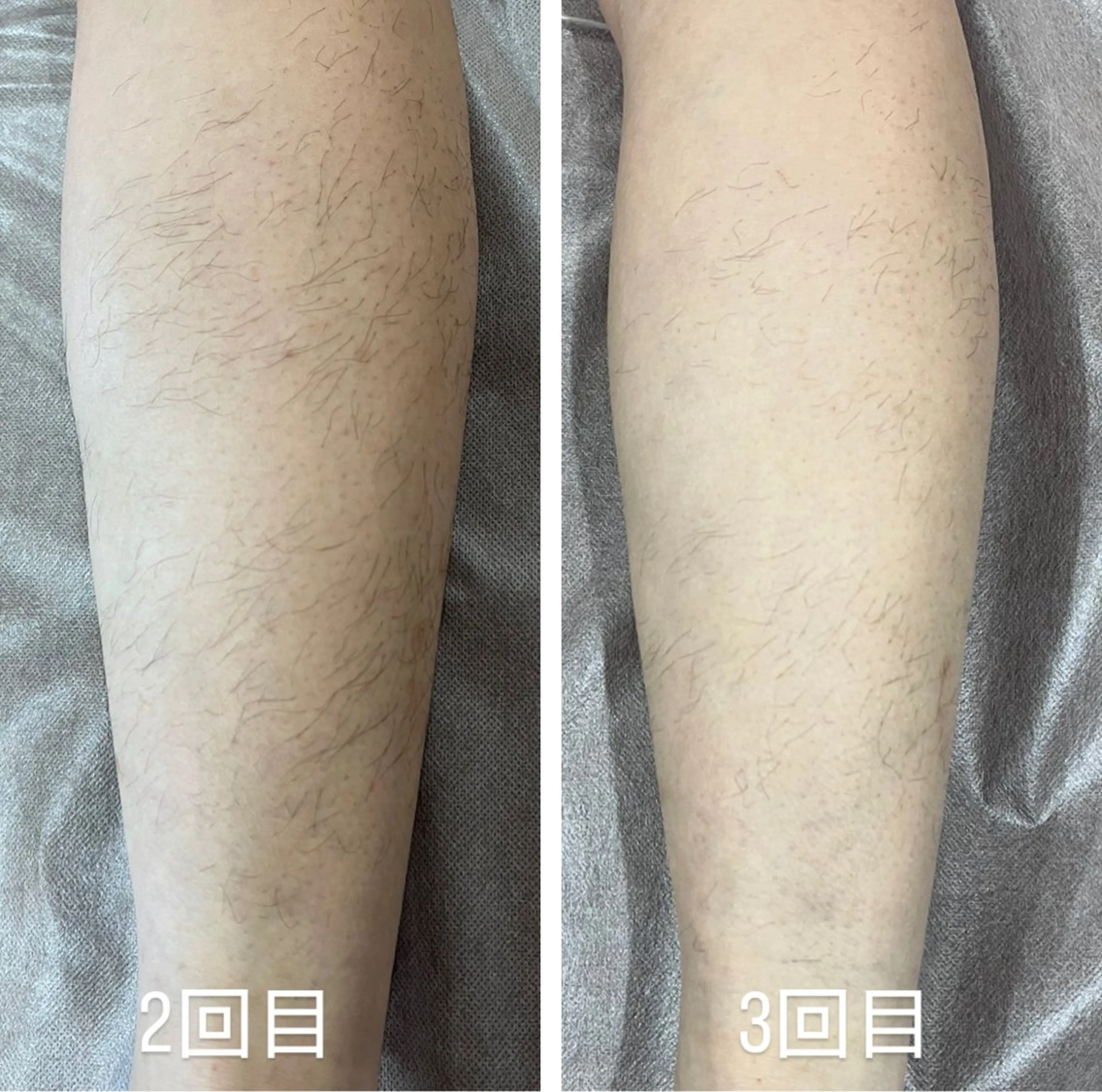 てらもと ほのかのエステ・リラクイメージ