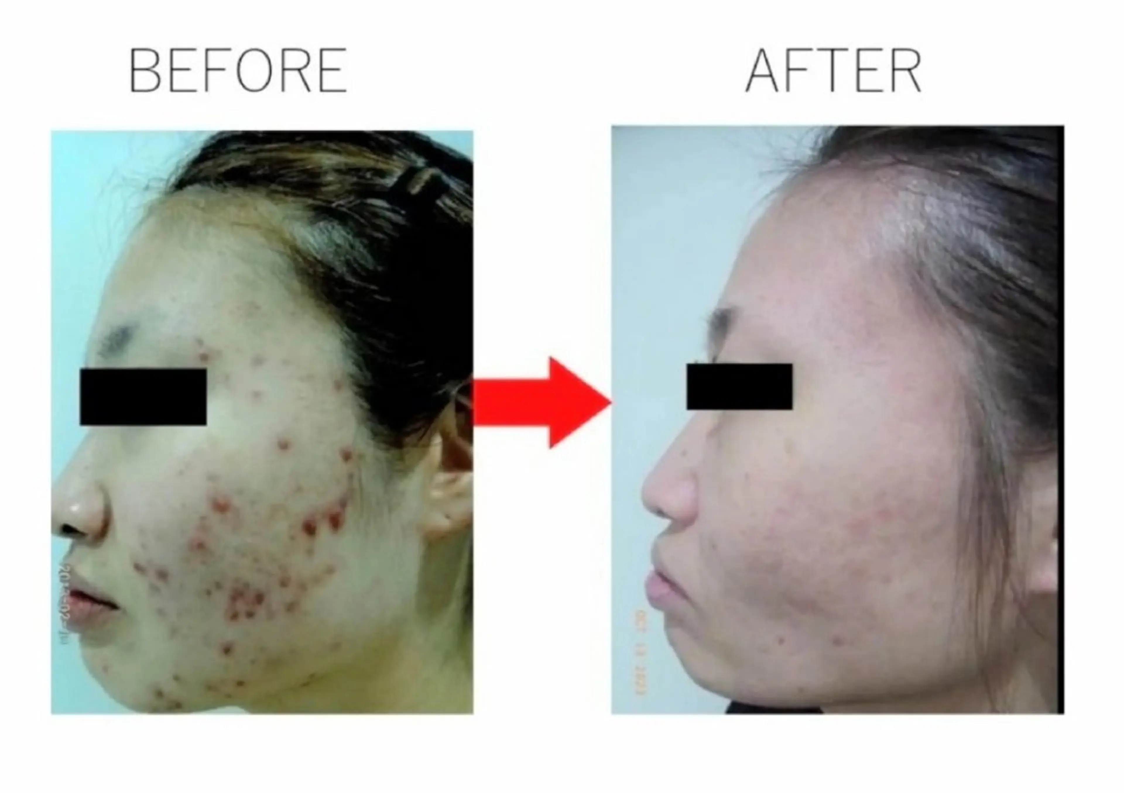 肌質改善専門サロン 川島 彩のエステ・リラクイメージ