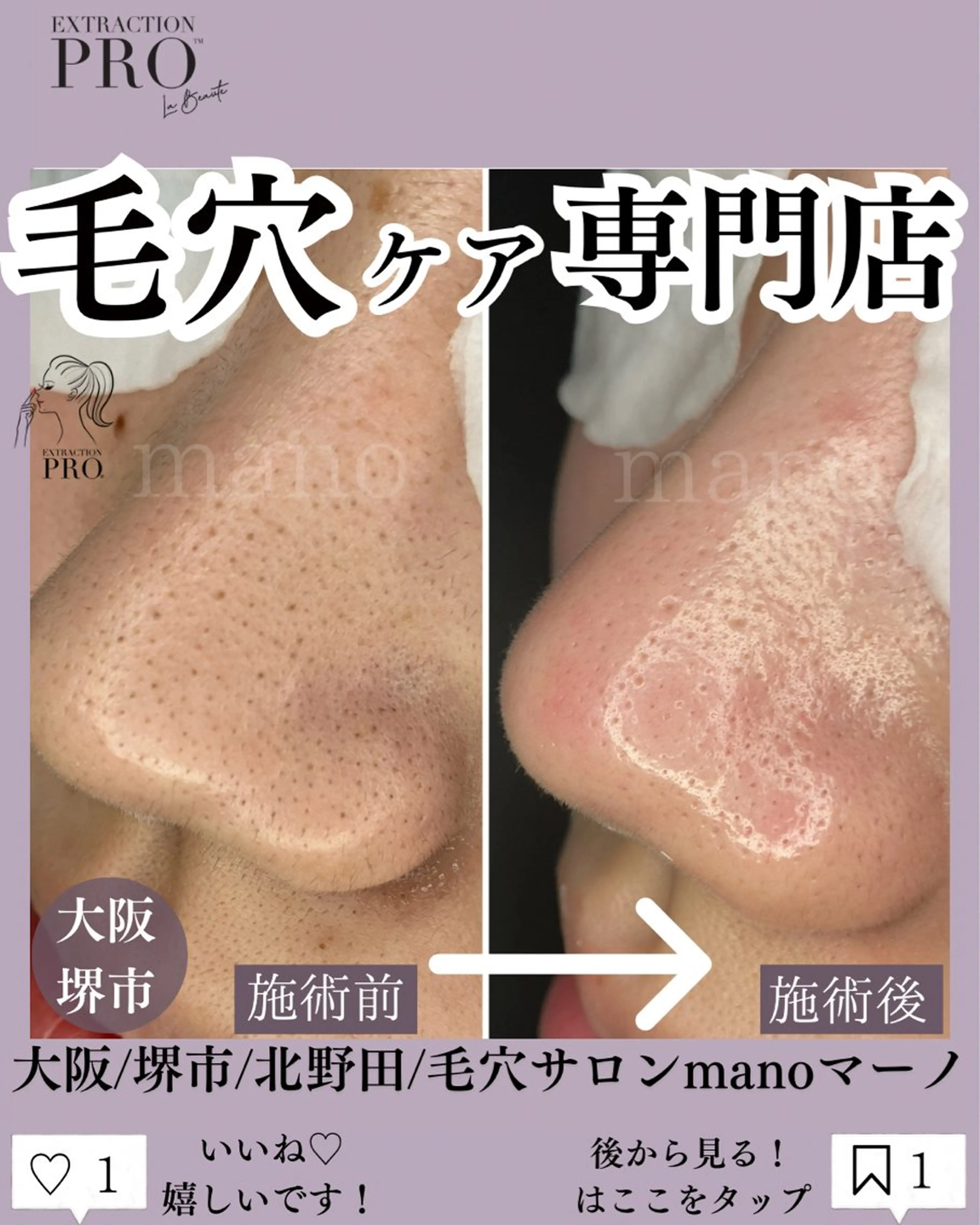 【当店1番】人気毛穴美人コースの写真