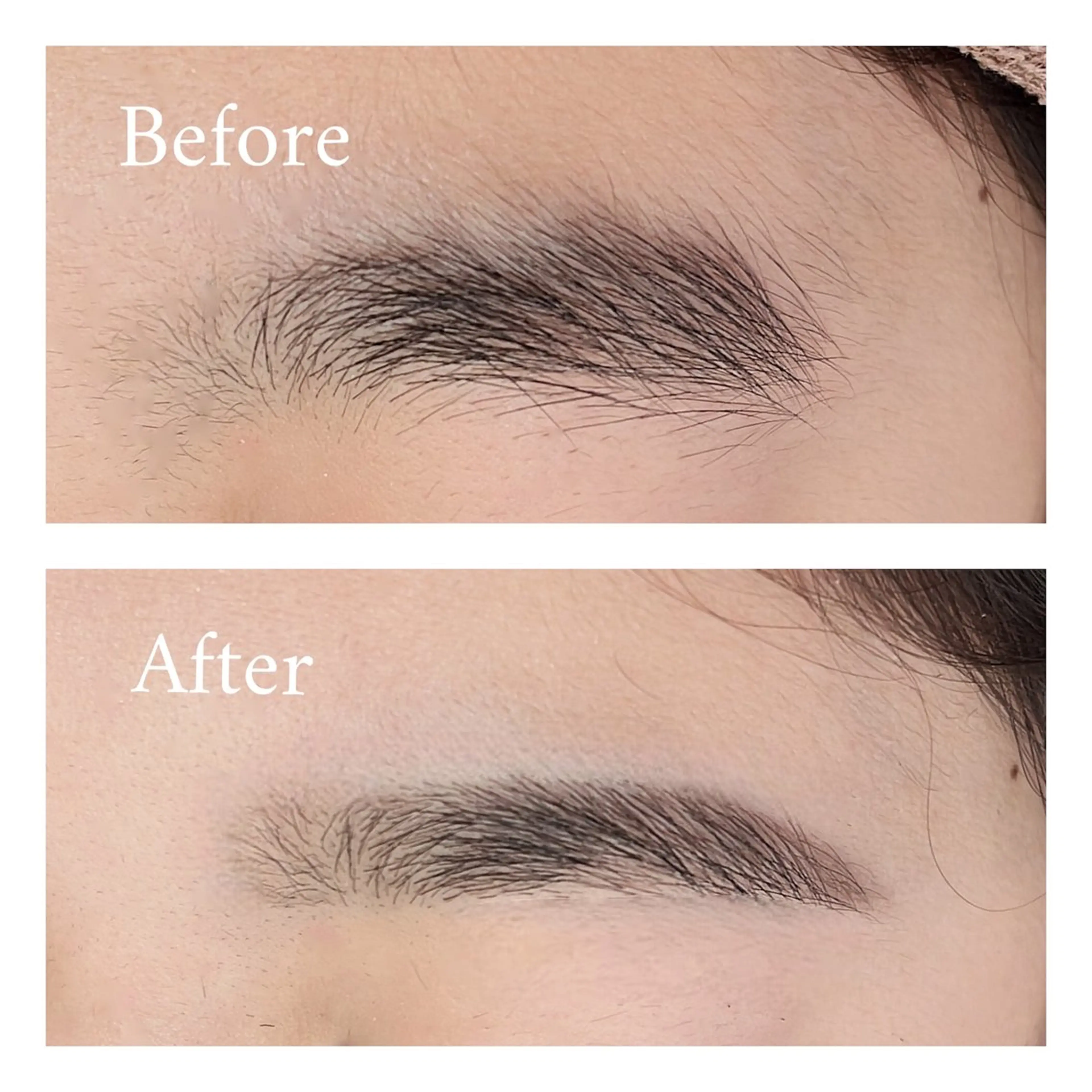 シートWax脱毛で垢抜け💙の写真