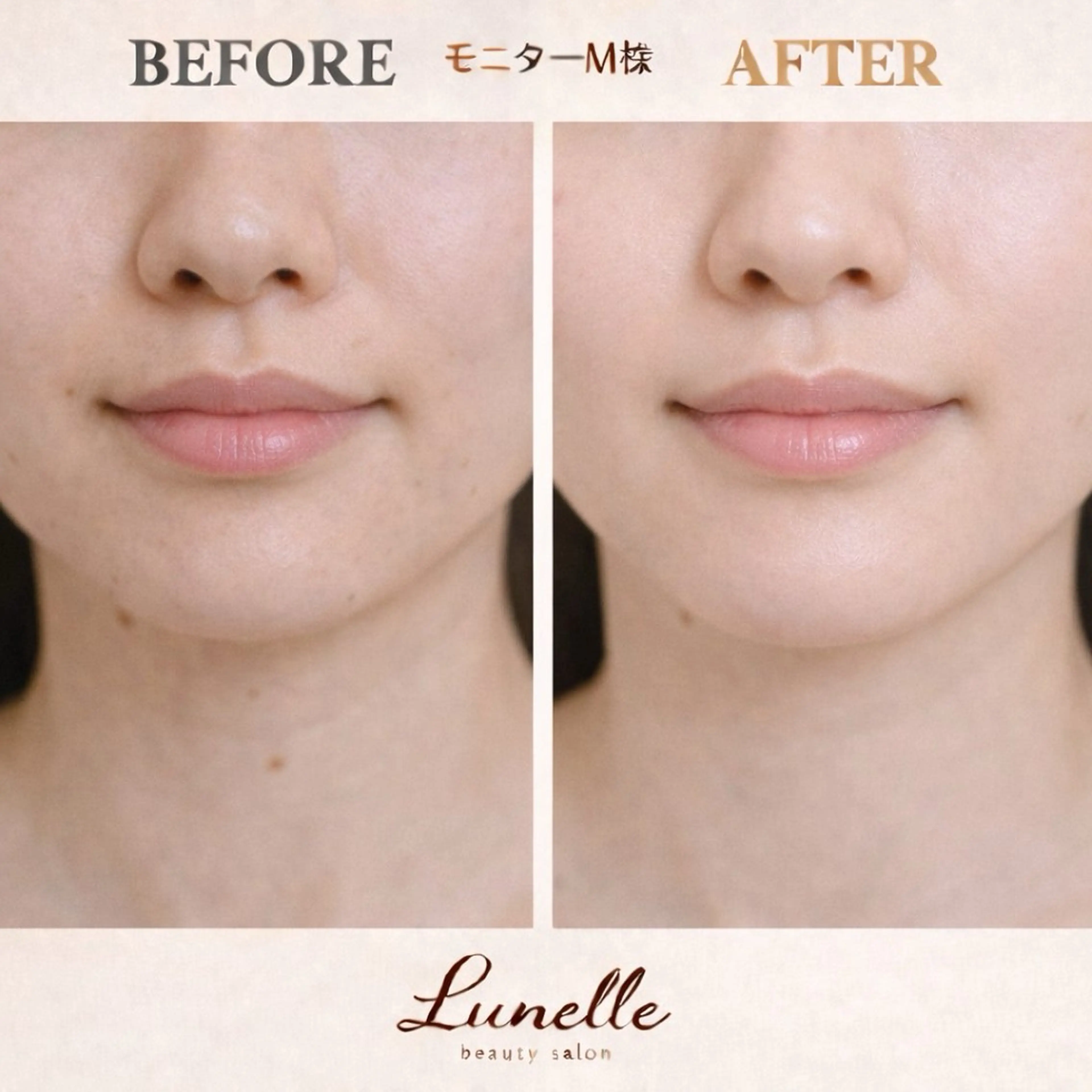 脱毛 脱毛×肌管理サロン ルネルのエステ・リラクイメージ