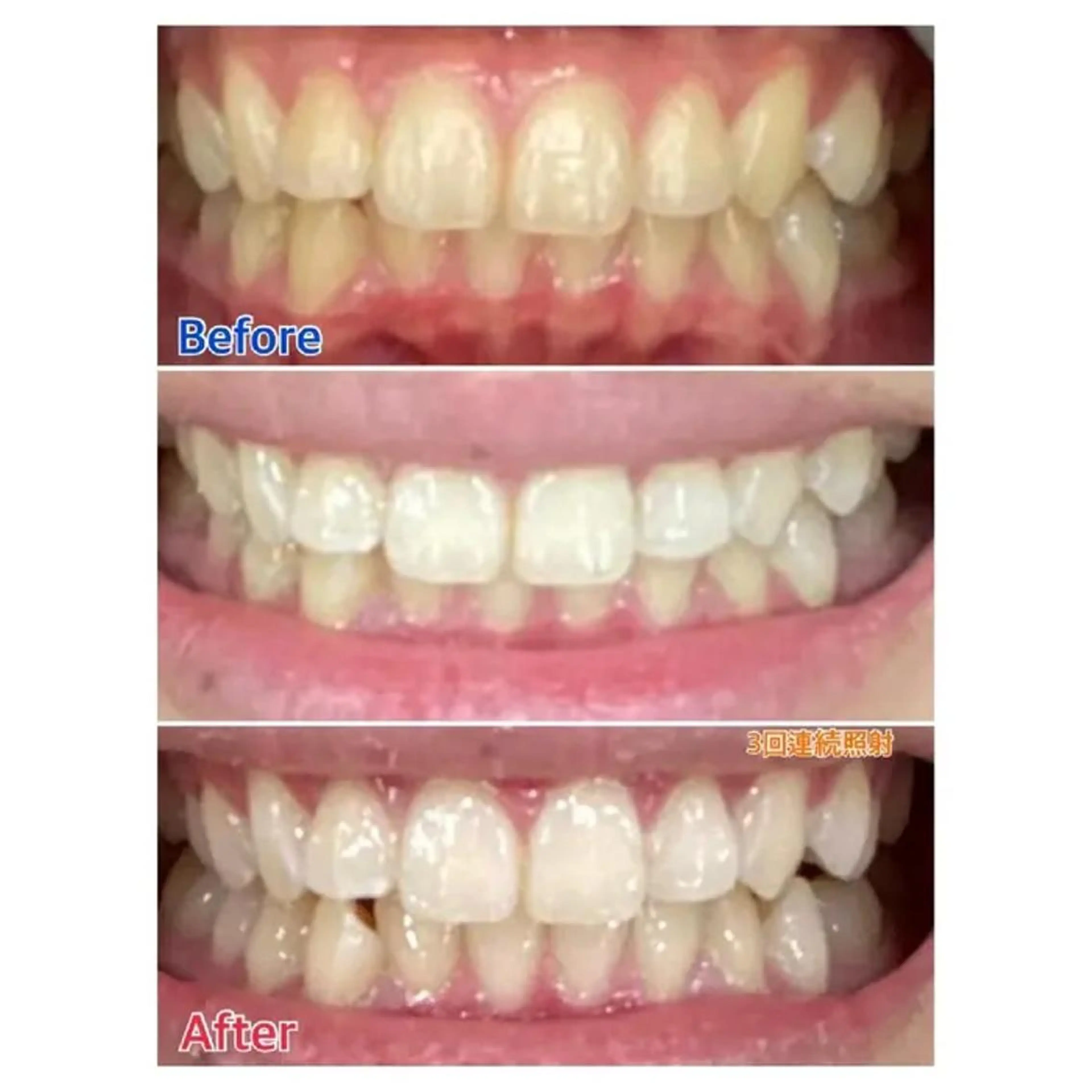 M渋谷店所属・Ｍ渋谷 ホワイトニングのその他イメージ