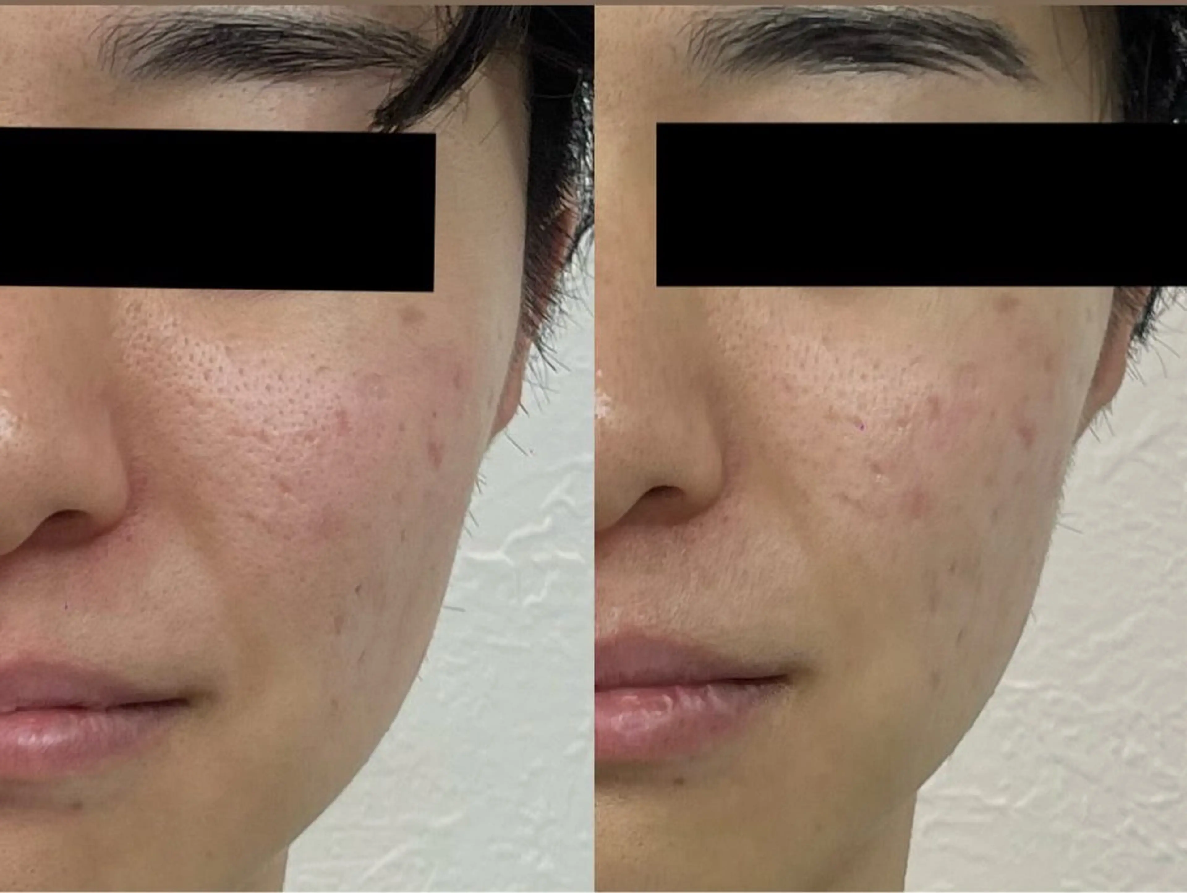 エステ Mr.&Ms.脱毛 NATSUMIのエステ・リラクイメージ