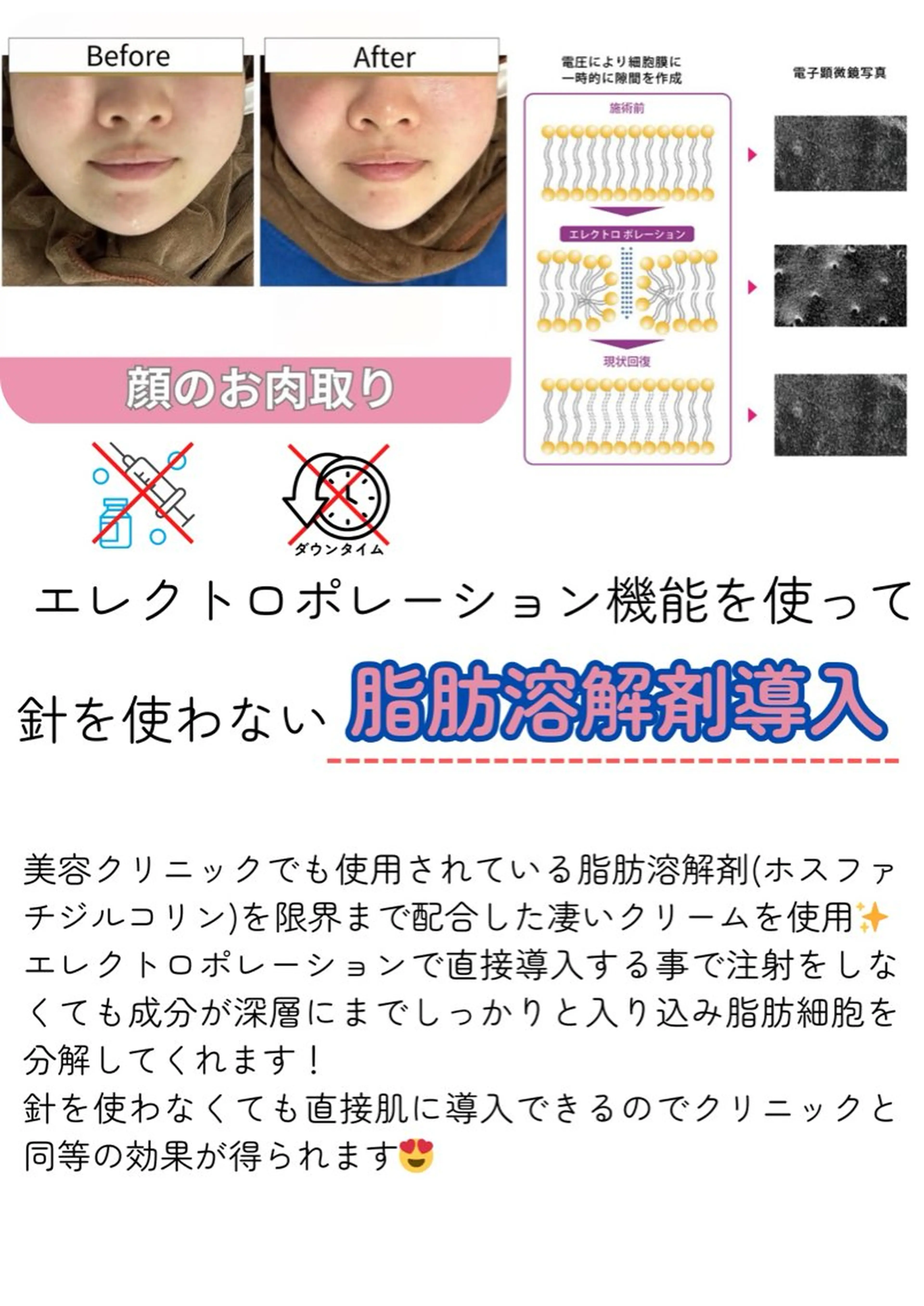 脂肪冷却/美肌改善 COCOKARAのエステ・リラクイメージ