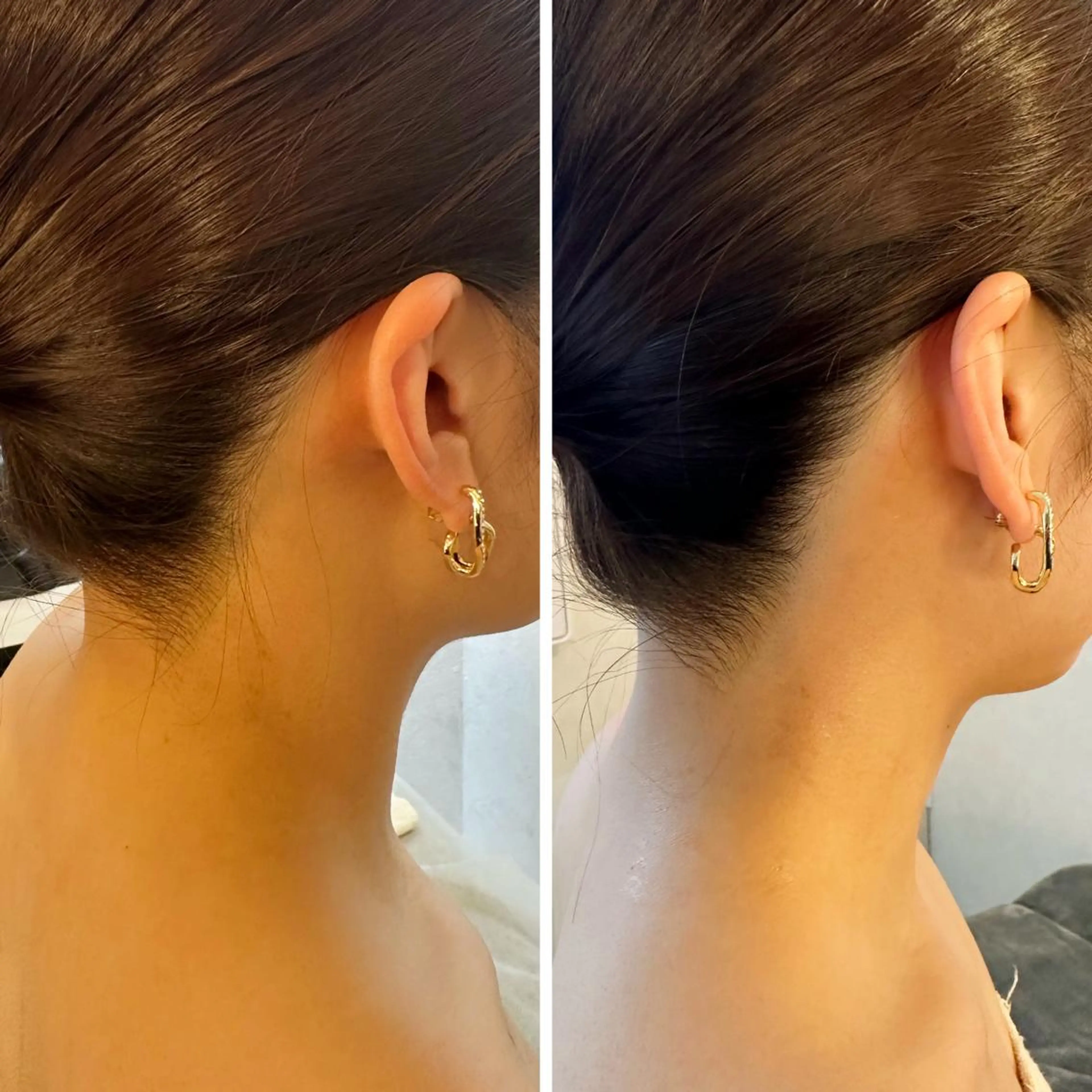 うなじ脱毛/美肌脱毛 LABELのエステ・リラクイメージ