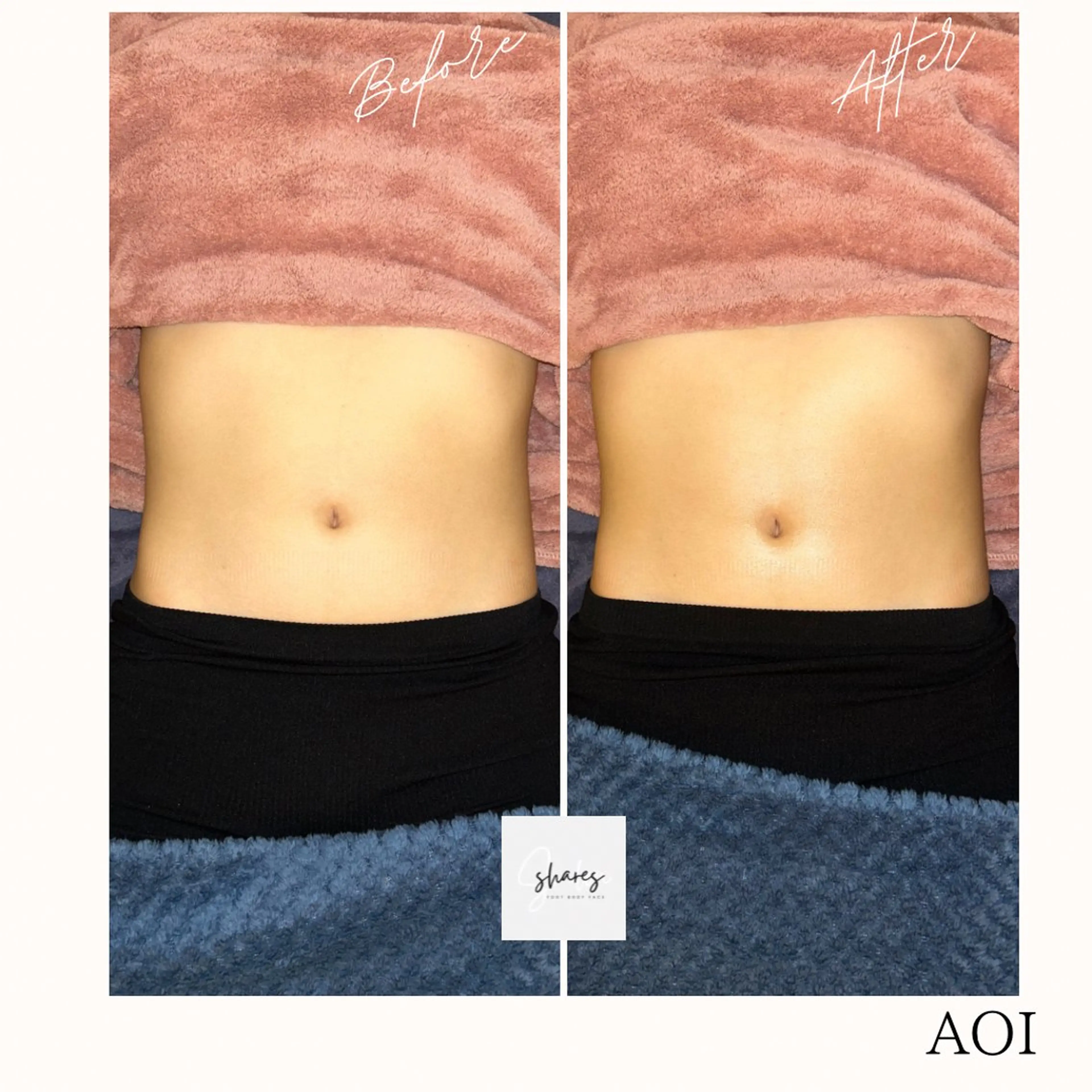 salon shares 辻堂店所属・SHARES AOIのエステ・リラクイメージ